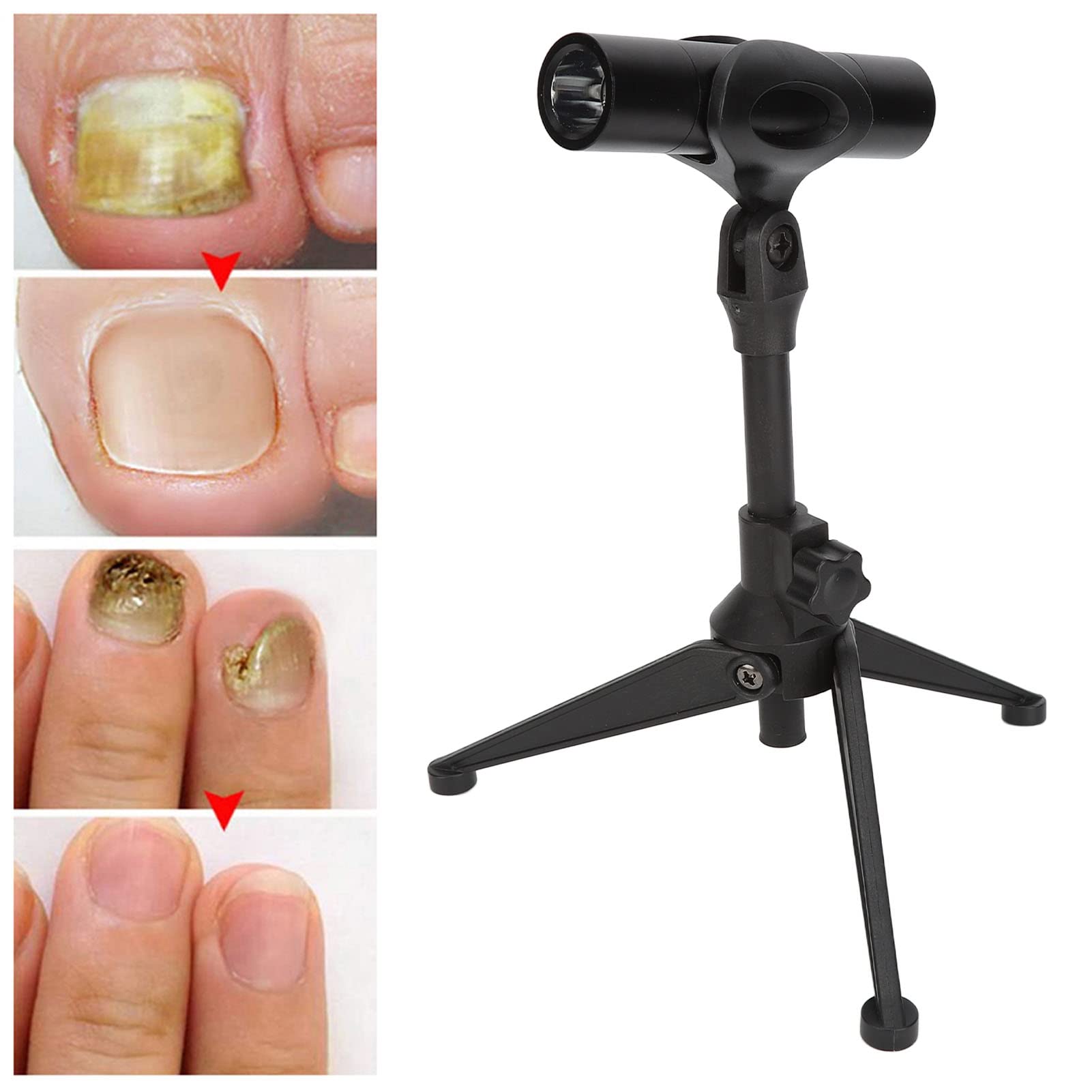 Portable Nail Fungus Laser Treatment Pen - Effective Home Nail Care Device for Toenails & Fingernails (Black) | Fast Painless Treatment for Healthy Nails at Home or Travel