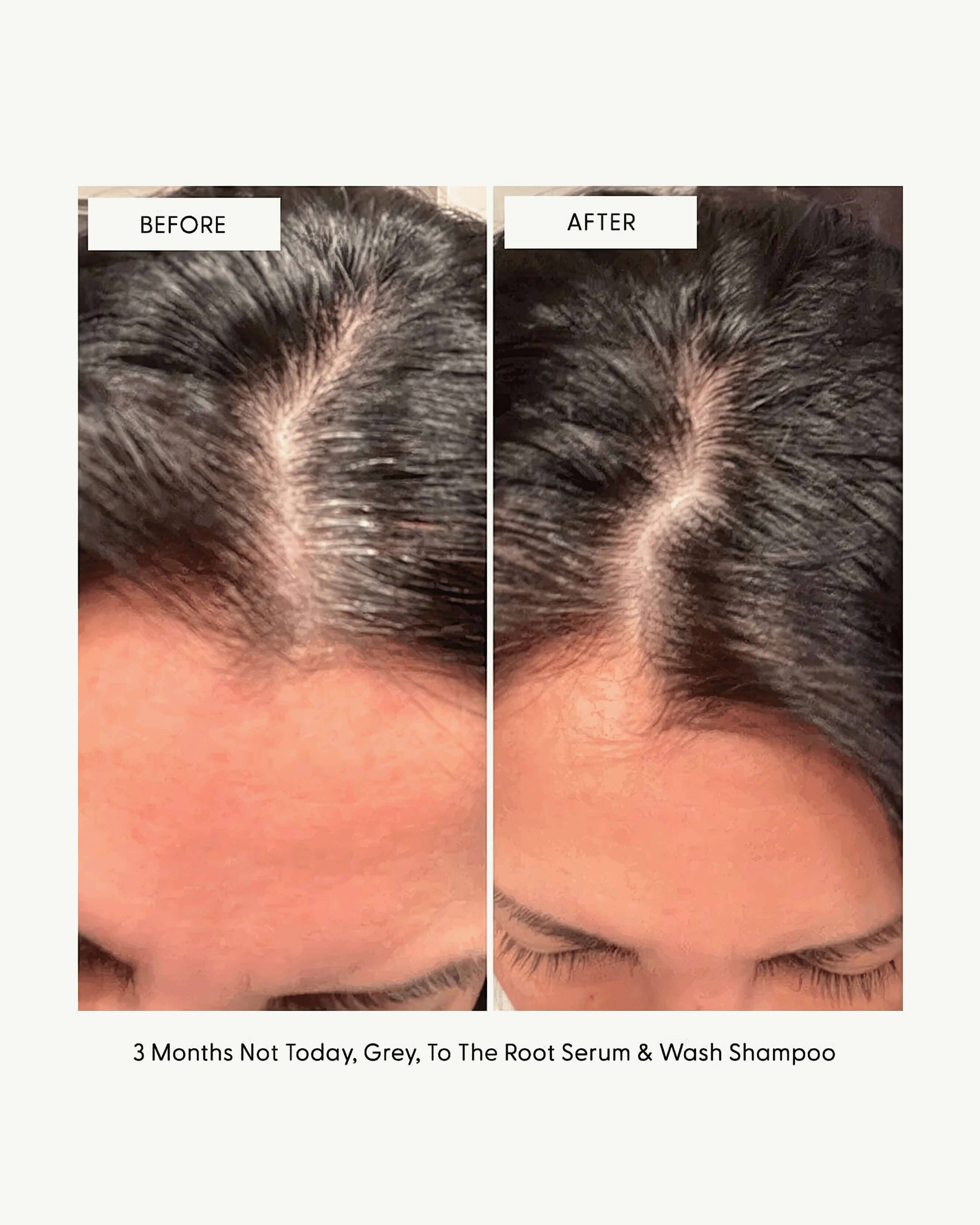 To The Root Hair Growth Serum - Natural & Organic Scalp Treatment for Thicker, Stronger Hair - Perfect for Daily Use at Home or Salon