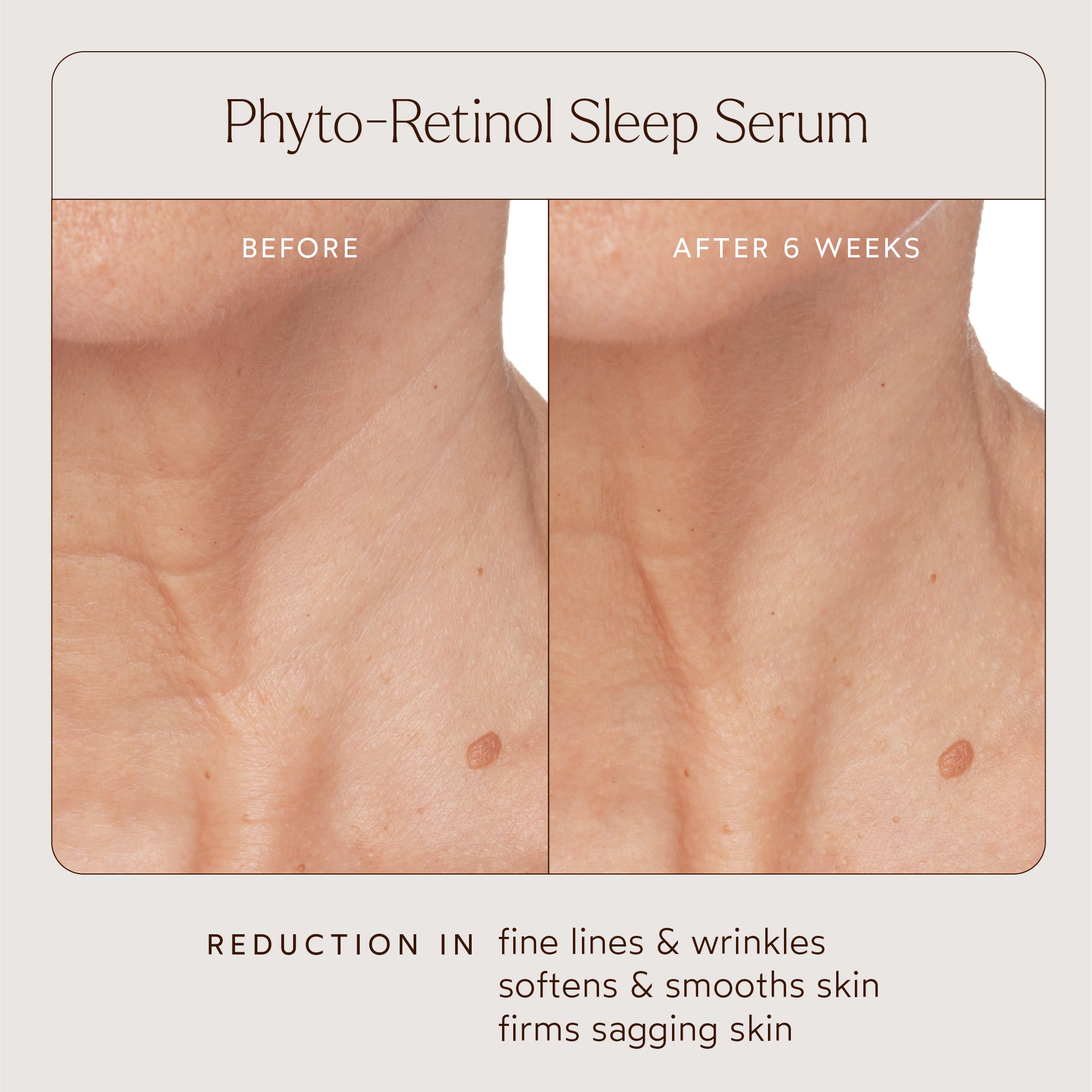 Best Phyto Retinol Anti-Aging Sleep Serum for Wrinkles & Fine Lines - Overnight Skin Repair Treatment for Youthful Glow | Perfect for Nighttime Skincare Routine