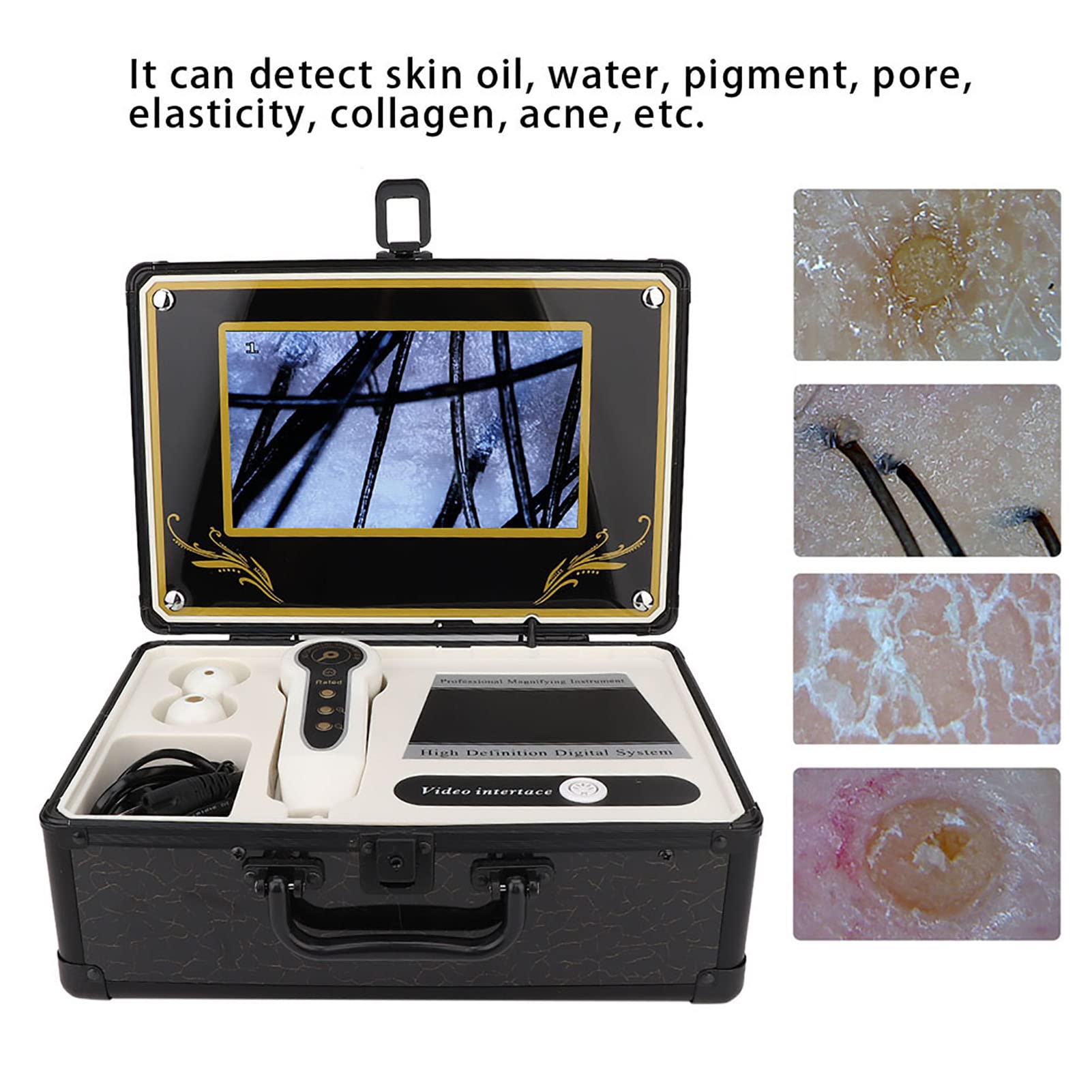 50X-200X Skin & Hair Analyzer Microscope - Professional Scalp Detector for Hair Follicle & Oil Analysis | Skin Care Diagnostic Tool with Magnifying Lens (US Plug) | Perfect for Home Hair Care & Dermatology Checkups