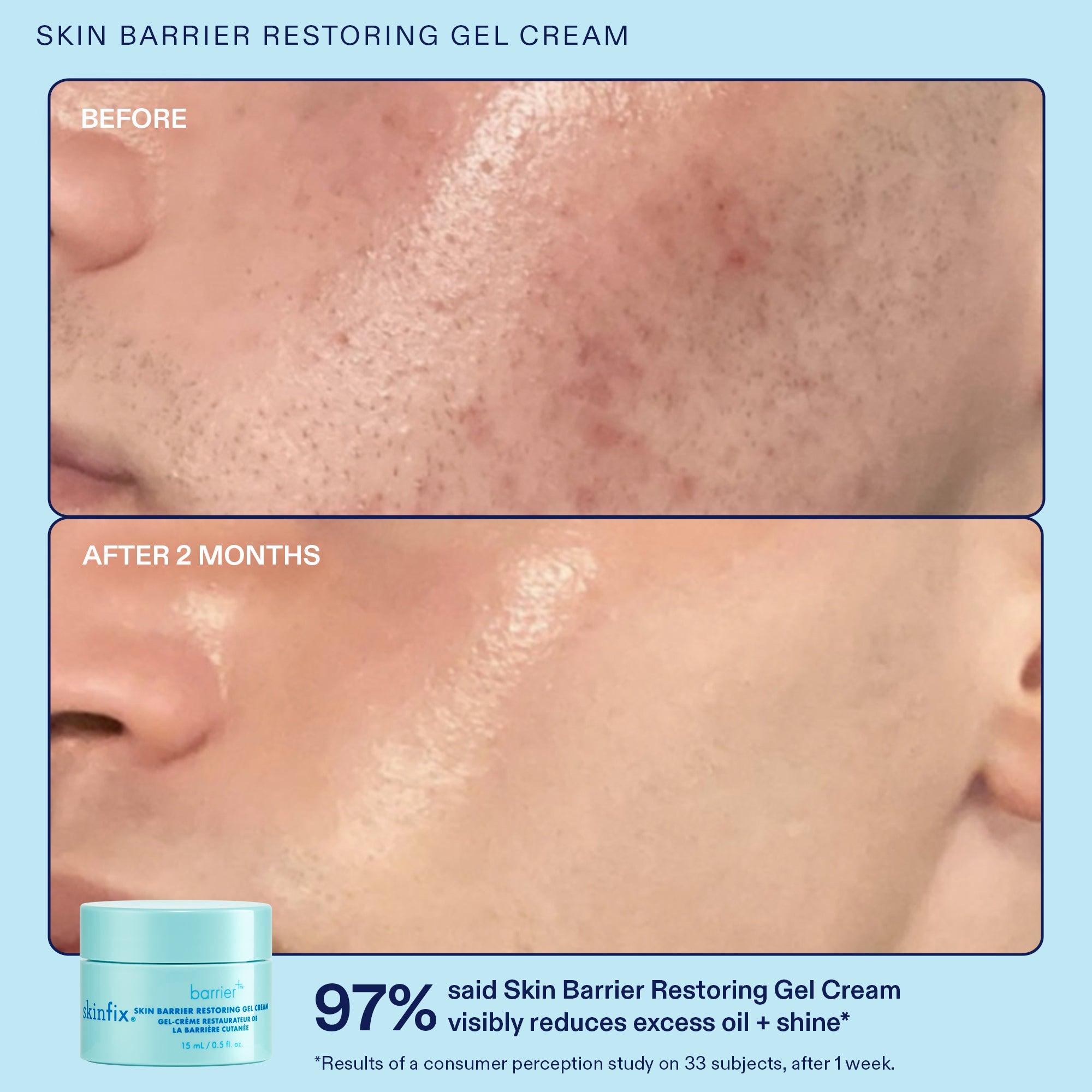 Barrier+ Plump + Refine Lip Gloss - Hydrating & Volumizing Lip Plumper with Natural Oils for Fuller Lips | Perfect for Daily Wear, Date Night & Special Occasions
