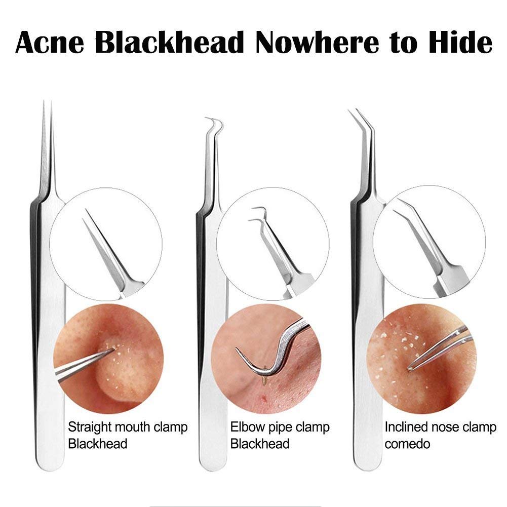 Bestgle Professional 10-Piece Blackhead Remover Kit - Stainless Steel Acne Pimple Extractor & Comedone Tweezers for Whitehead & Blemish Treatment - Perfect for At-Home Facial Care & Skin Cleaning Routine