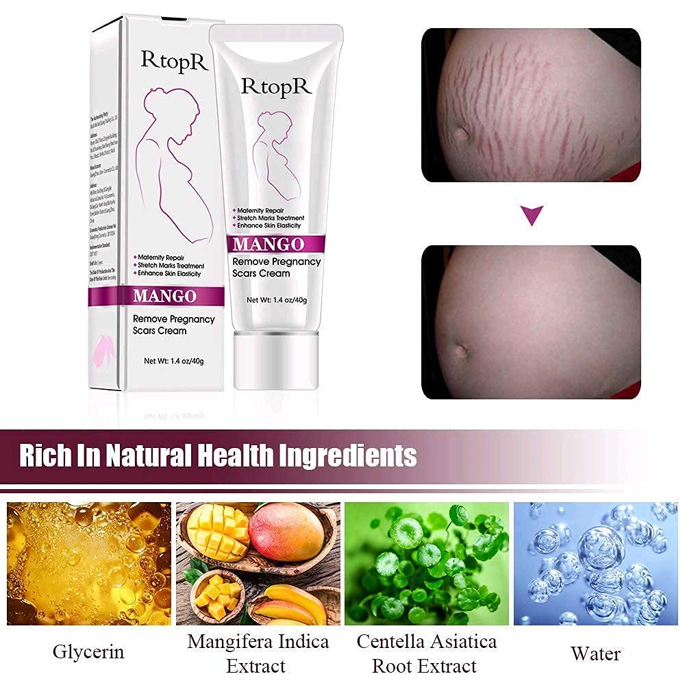 RtopR Mango Stretch Marks & Scar Removal Cream for Pregnancy - Best Body Moisturizer for Smooth Skin - 80g - Perfect for Postpartum Care & Skin Repair