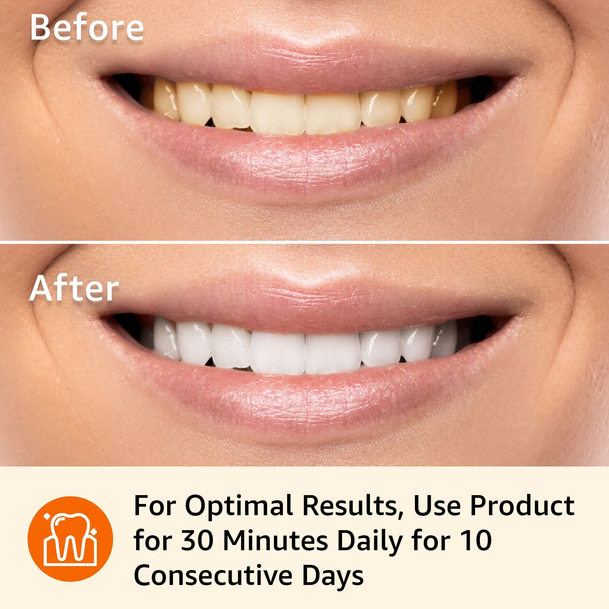 Amazon Basics 10-Day Teeth Whitening Strips Kit - 20 Strips (10 Treatments) for Whiter Teeth at Home - Enamel Safe, Dentist Recommended Whitening Solution for Coffee & Wine Stains Removal - Perfect for Weddings, Job Interviews & Special Occasions