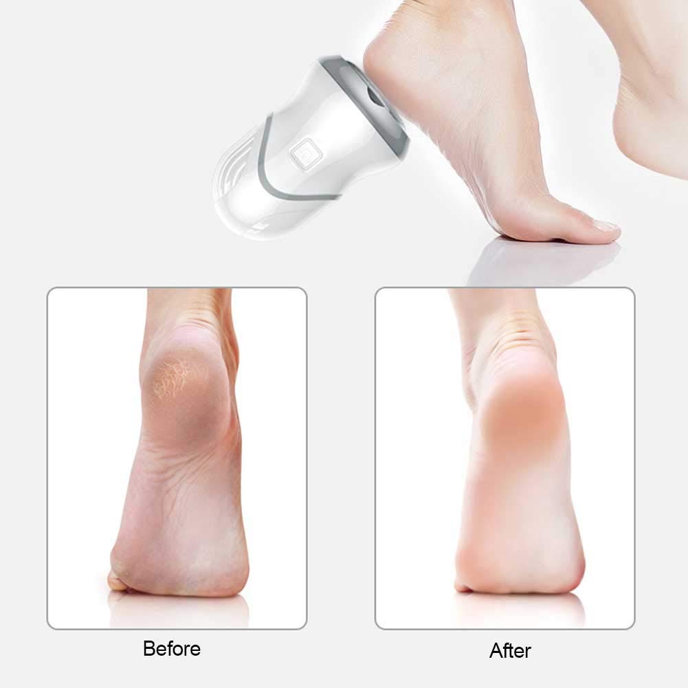 Electric Foot Callus Remover & Pedicure Kit - USB Rechargeable Foot Grinder for Soft Smooth Feet - Battery Operated Exfoliating Foot File - Perfect for At-Home Pedicures & Dead Skin Removal