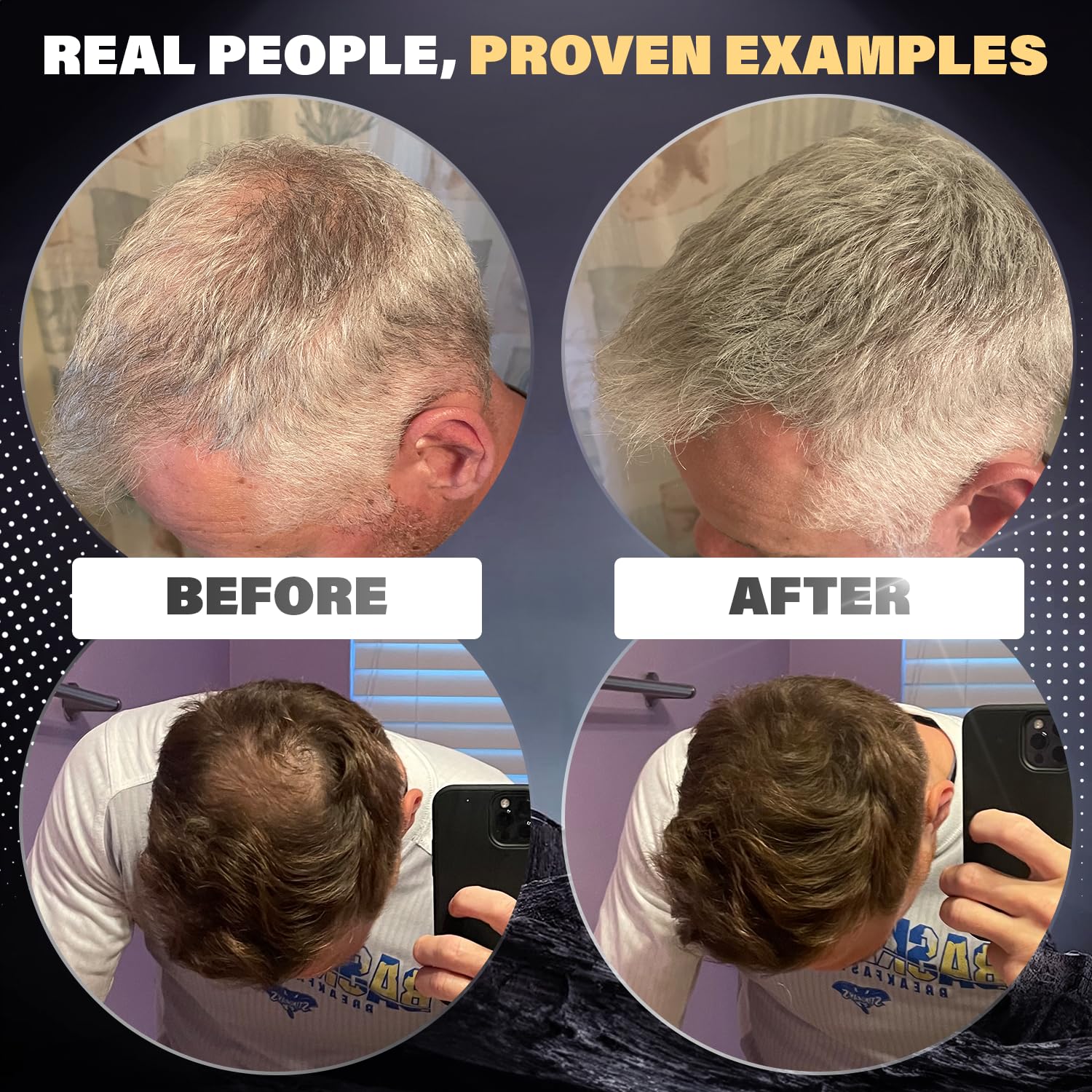 Dark Brown Hair Fibers for Thinning Hair - 100% Natural Undetectable Hair Building Powder for Men & Women | Conceals Bald Spots & Hair Loss | 2 Month Supply | Perfect for Daily Use, Work, and Social Events