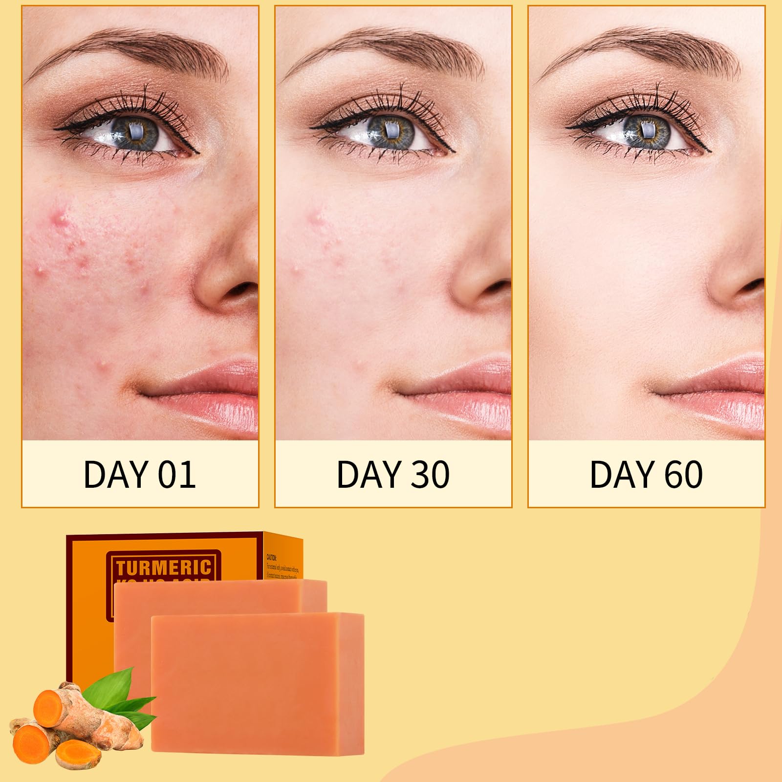 Turmeric Kojic Acid Soap Bar 200g/7oz - Natural Skin Brightening Soap for Face & Body, Acne Treatment, Dark Spot Remover, Even Skin Tone - Perfect for Daily Cleansing, Blemish Control & Easter Gifts
