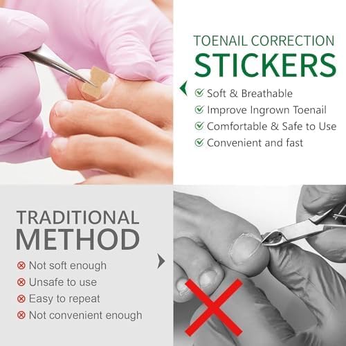 **50 Pcs Breathable Ingrown Toenail Corrector Patches - Painless No Glue Solution for Ingrown Nails, Fast Repair & Stays Secure - Perfect for Athletes, Runners & Daily Comfort**