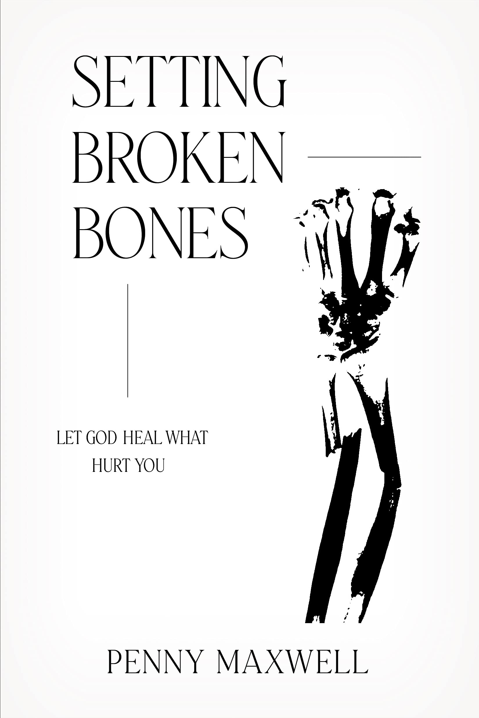 Orthopedic Splints for Broken Bones - First Aid Medical Supplies for Fractures & Sprains - Ideal for Emergency Kits, Sports Injuries & Home Use