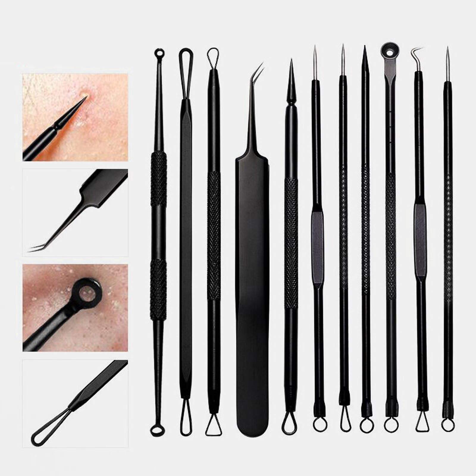 11-Piece Blackhead Remover Kit - Professional Pimple Popper Tool & Acne Extractor Set for Blackheads & Whiteheads - Perfect for Home Skincare & Facial Treatment