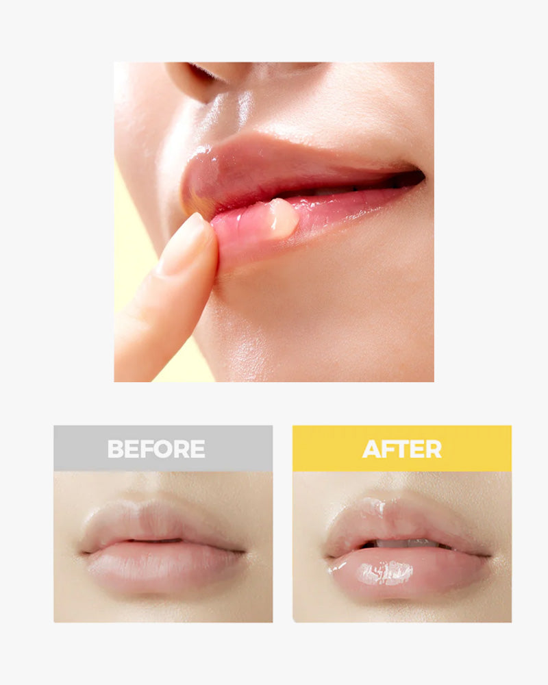 CNP Propolis Lipcerin Lip Balm - Natural Moisturizing & Healing Lip Care for Dry, Chapped Lips - Perfect for Daily Use, Winter Protection & On-the-Go Hydration