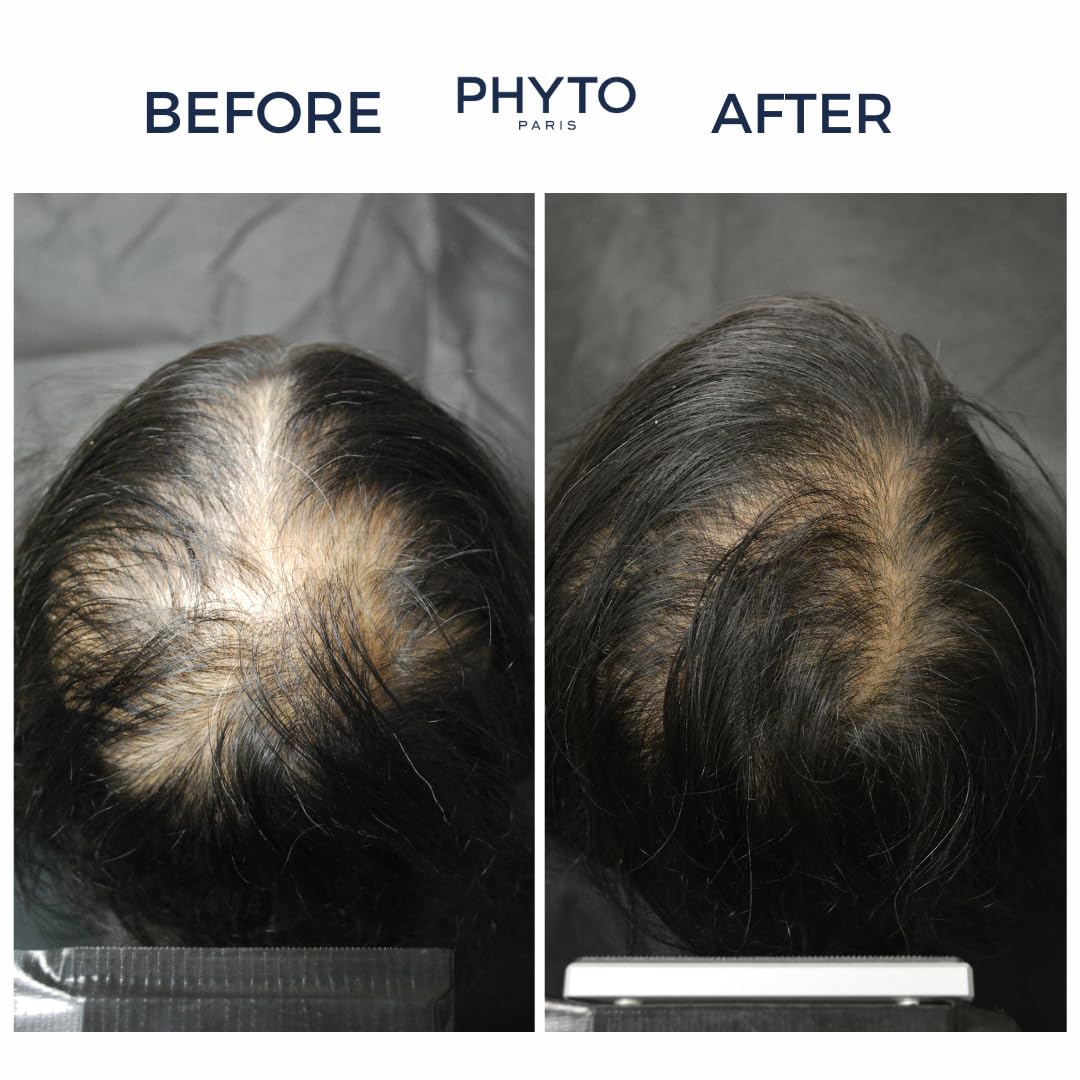 PHYTO Phytonovathrix Botanical Hair Loss Treatment for Thinning Hair - Natural Solution for Hair Regrowth & Thickness (For Men & Women at Home)
