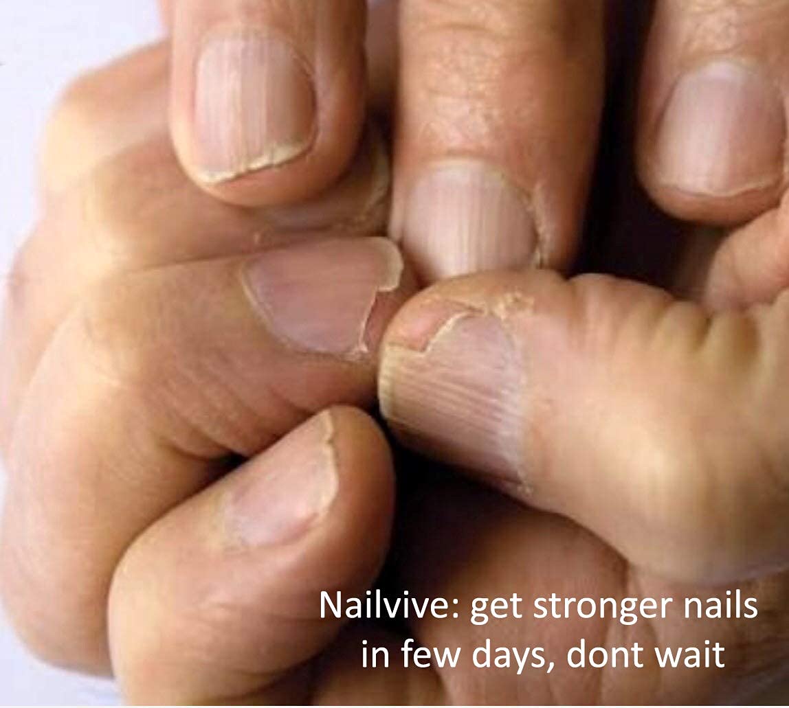 NAILVIVE Nail Strengthening Serum with Natural Keratin & Silk Proteins - Hardens & Repairs Weak, Brittle Nails - Prevents Splitting, Chipping, Peeling & Cracking - Perfect for Salon-Quality Nails at Home or Professional Use