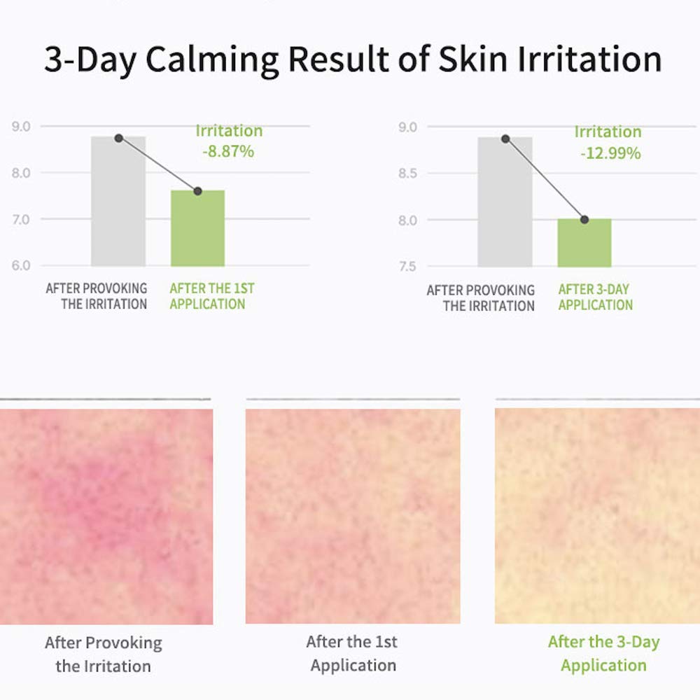 Celimax The Real Noni Energy Repair Cream - Ceramide Moisturizer for Wrinkles, Fine Lines & Anti-Aging | Hydrating, Soothing & Brightening Face Cream for Sensitive, Dry & Oily Skin (50ml) | Daily Skincare Routine & Night Repair Treatment