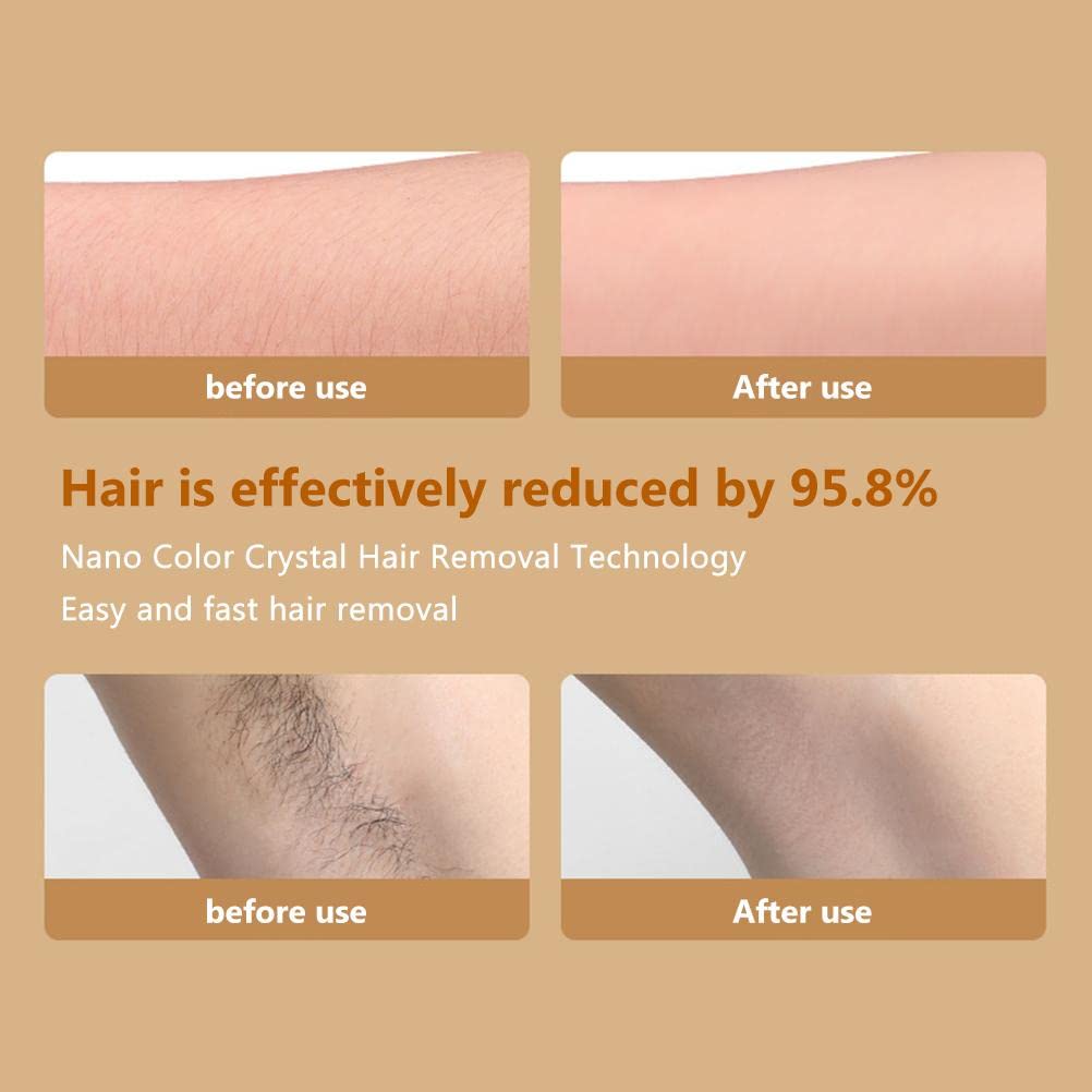 Crystal Nano Hair Eraser for Women & Men - Painless Hair Removal Without Shaving - Rose Gold Hair Remover for Arms, Legs, Back & Body | Perfect for Smooth Skin at Home, Travel & Salon Use