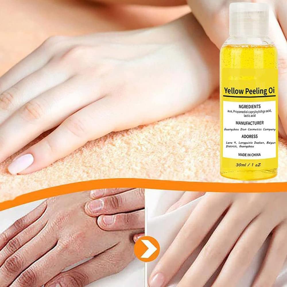 Aumude Super Strength Yellow Peeling Oil - Skin Lightening & Exfoliating Treatment for Dark Spots on Body, Face, Hands & Feet (30ml) | Brighten Skin Tone, Remove Dead Cells & Even Complexion | Perfect for Post-Sun Care, Pre-Wedding Glow & Daily Skincare Routine