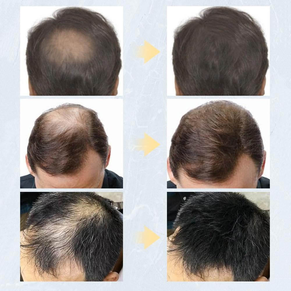 Kabello Fiber Hair Powder for Men & Women - Natural Hair Thickening & Bald Spot Coverage - 15g Brown | Instant Volume & Confidence for Daily Styling & Special Occasions