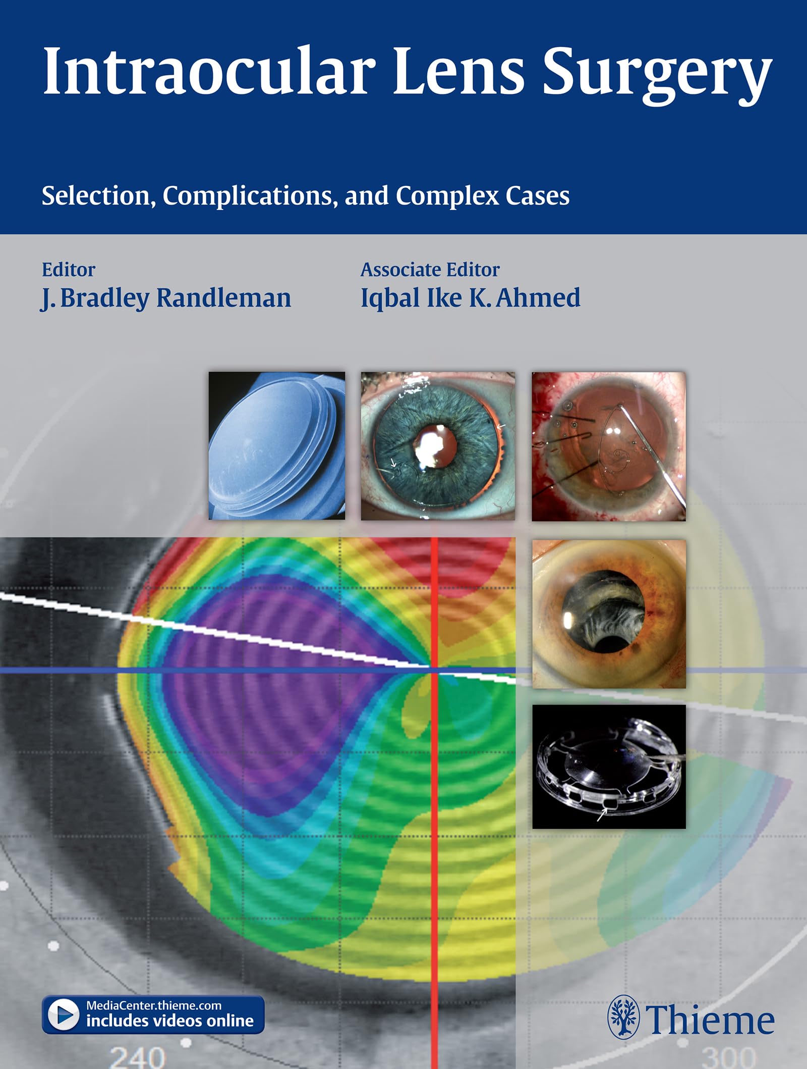 Intraocular Lens Surgery Guide: Selection, Complications & Complex Cases for Cataract Treatment and Vision Correction