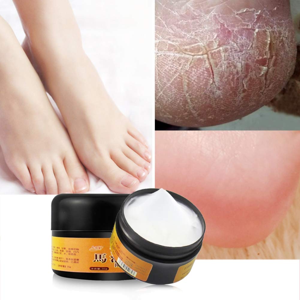 Allbestaye Horse Oil Foot Cream for Dry Cracked Heels - Intensive Repairing Moisturizer for Rough & Chapped Feet - Best for Cracked Heel Treatment & Foot Care at Night