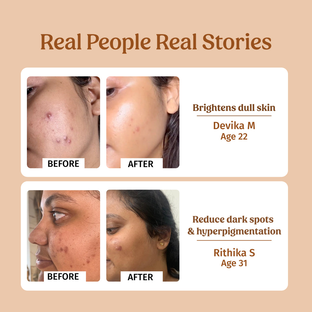 Milk Drops Brightening Serum for Glowing Skin - Vitamin C & Hyaluronic Acid Face Treatment | Perfect for Day & Night Skincare Routine