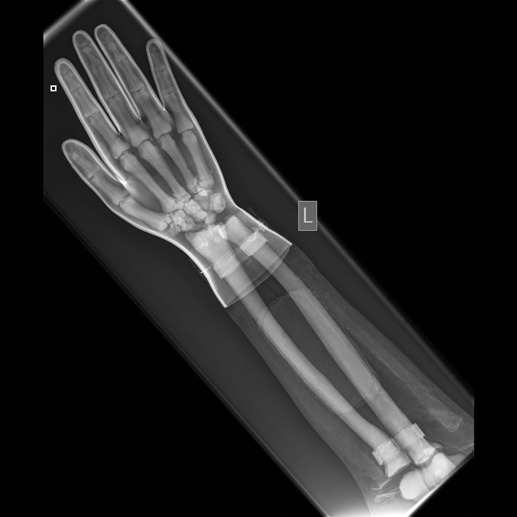 Full Body X-Ray and Radiographic Positioning Manikin - Professional Medical Training Model for Radiology Students & Technicians - Perfect for Classroom, Lab & Clinical Practice