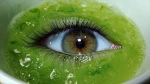 GOPIKA Aloe Vera Cooling Gel Eye Mask - Soothing Ice Pads for Dark Circles, Puffy Eyes & Fatigue Relief | Hydrating & Refreshing Under Eye Treatment for Summer & Sleep Care | Perfect for Travel, Work & Relaxation