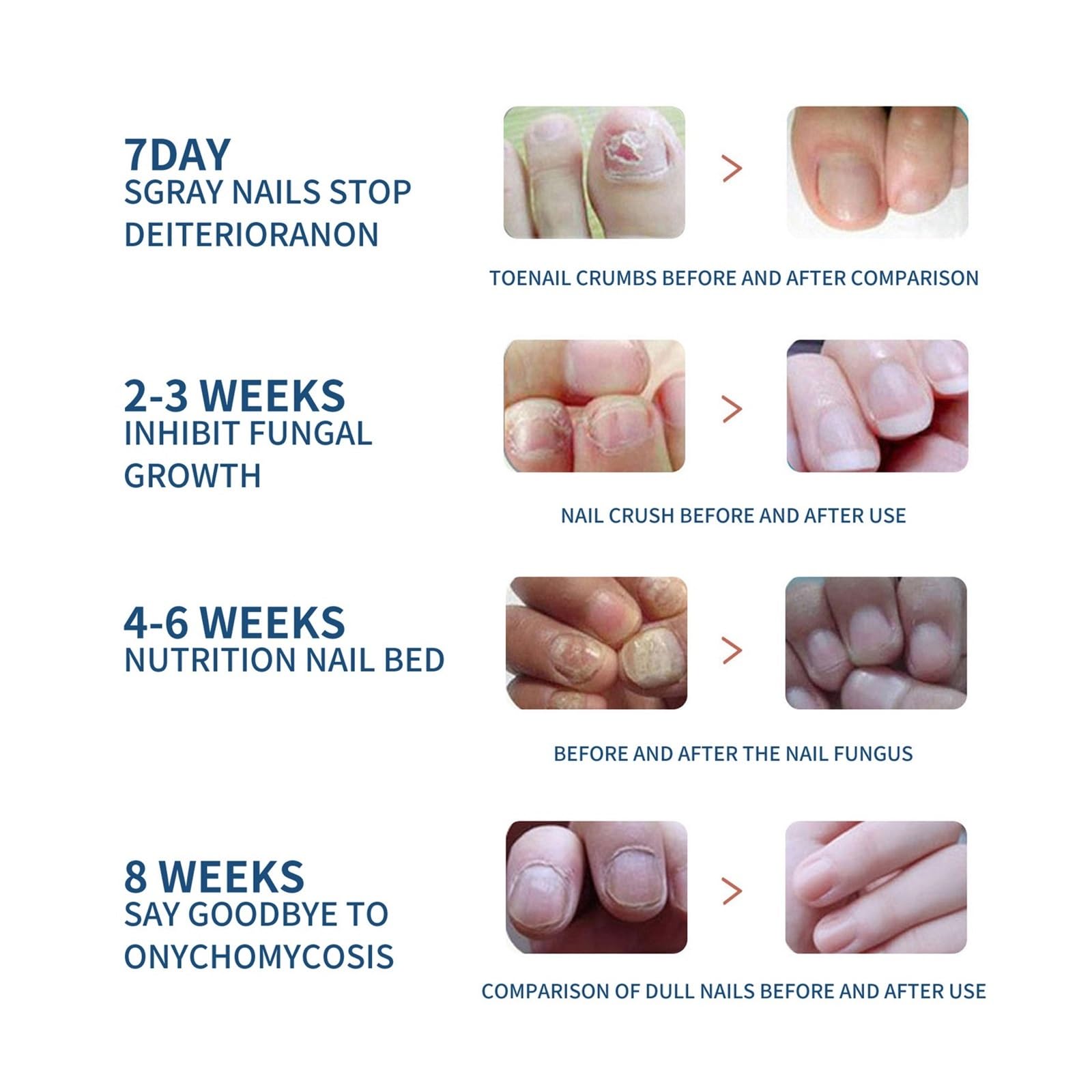 64 Pcs Nail Repair Patches - Damaged Nail Treatment for Cracked & Discolored Nails (Cream) | Strengthen & Beautify Nails for Salon-Quality Results at Home