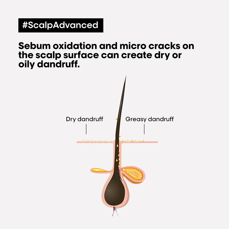 L'Oréal Professionnel Serie Expert Scalp Advanced Anti-Dandruff Shampoo - Dermo Clarifier for Flaky Scalp Treatment - Perfect for Daily Hair Care & Scalp Health Maintenance