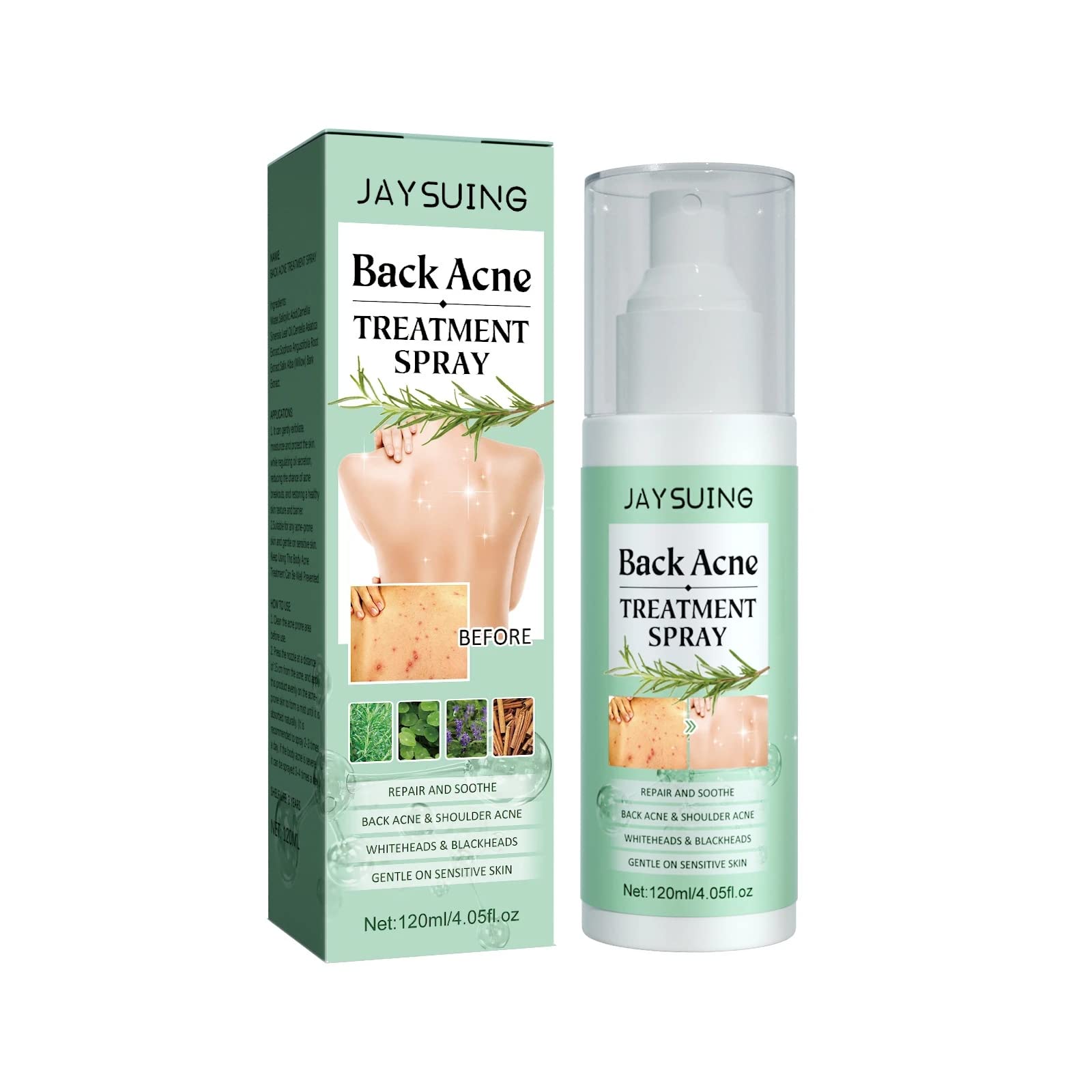 2% Salicylic Acid Back Acne Spray Treatment with Tea Tree Oil & Herbal Formula - 4.05 oz Acne Solution for Teens & Adults | Clear Body Breakouts for Gym, Sports & Daily Use