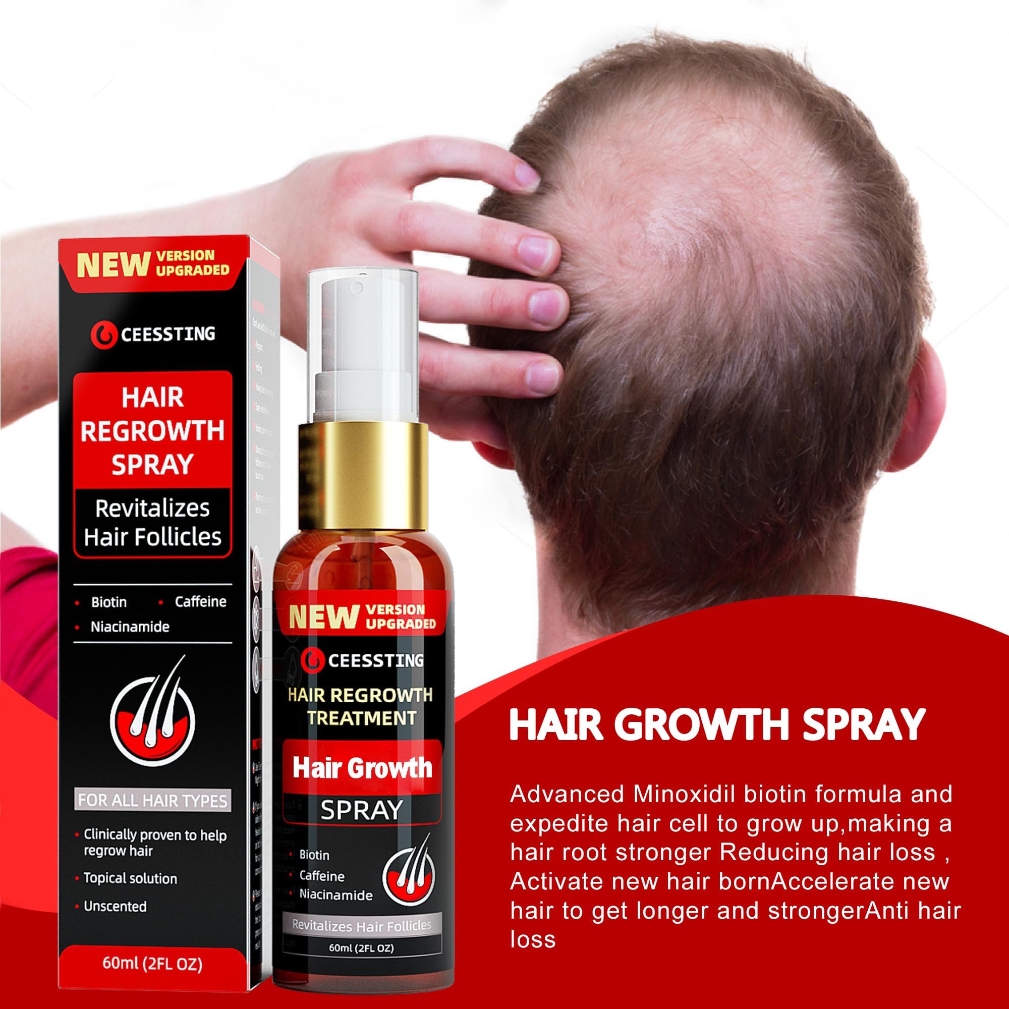 Ceessting Hair Growth Spray with Biotin, Caffeine & Niacinamide - Anti Hair Loss Treatment for Thinning Hair - Hair Regrowth Solution for Men & Women - 2oz - Perfect for Daily Use at Home, Salon or Travel