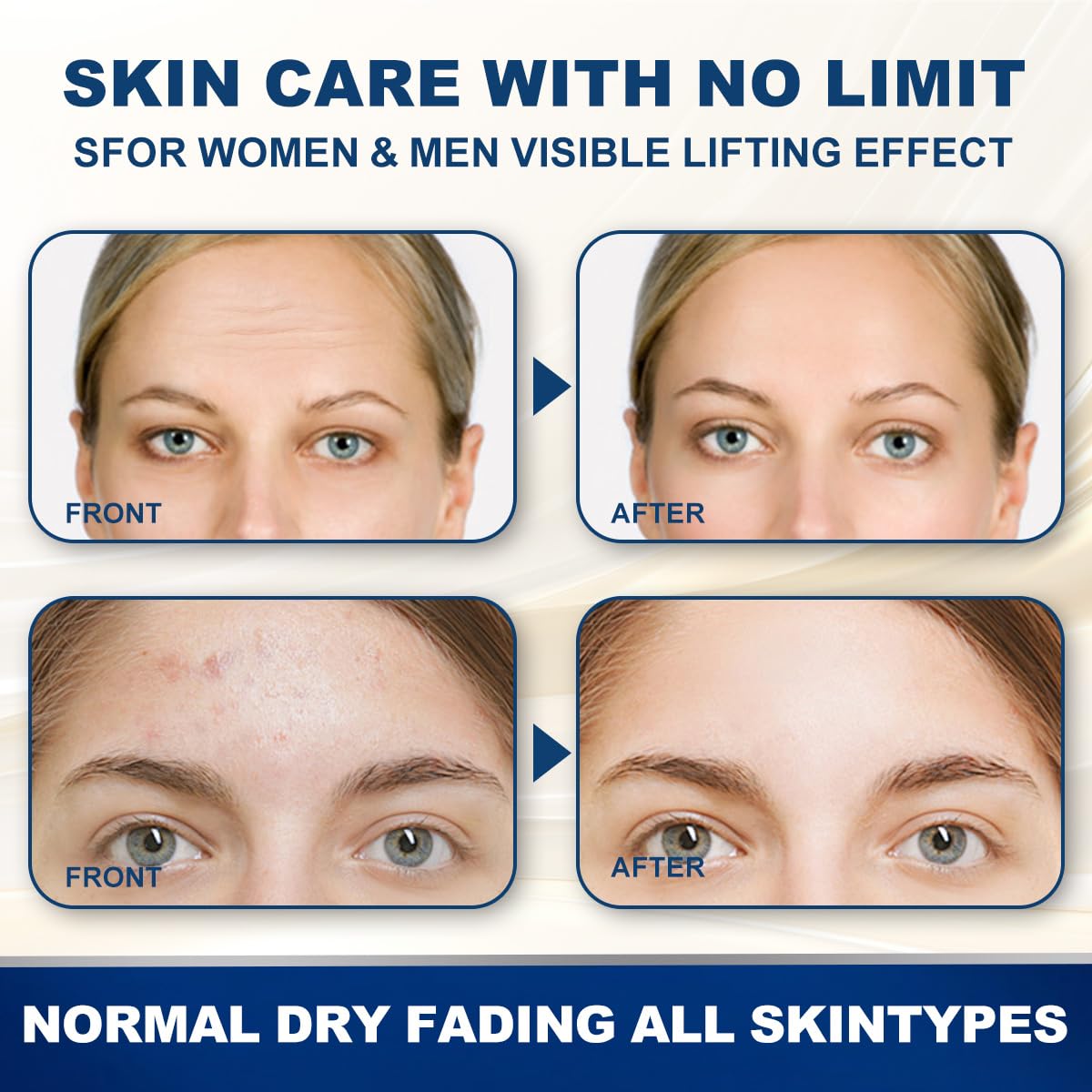 12Pcs Anti-Wrinkle Forehead Patches with Aloe, Niacinamide, Collagen & Vitamin E | Wrinkle Smoothing Treatment for Forehead Lines | Prevent & Reduce Fine Lines – Perfect for Overnight Use & Daily Skincare Routine