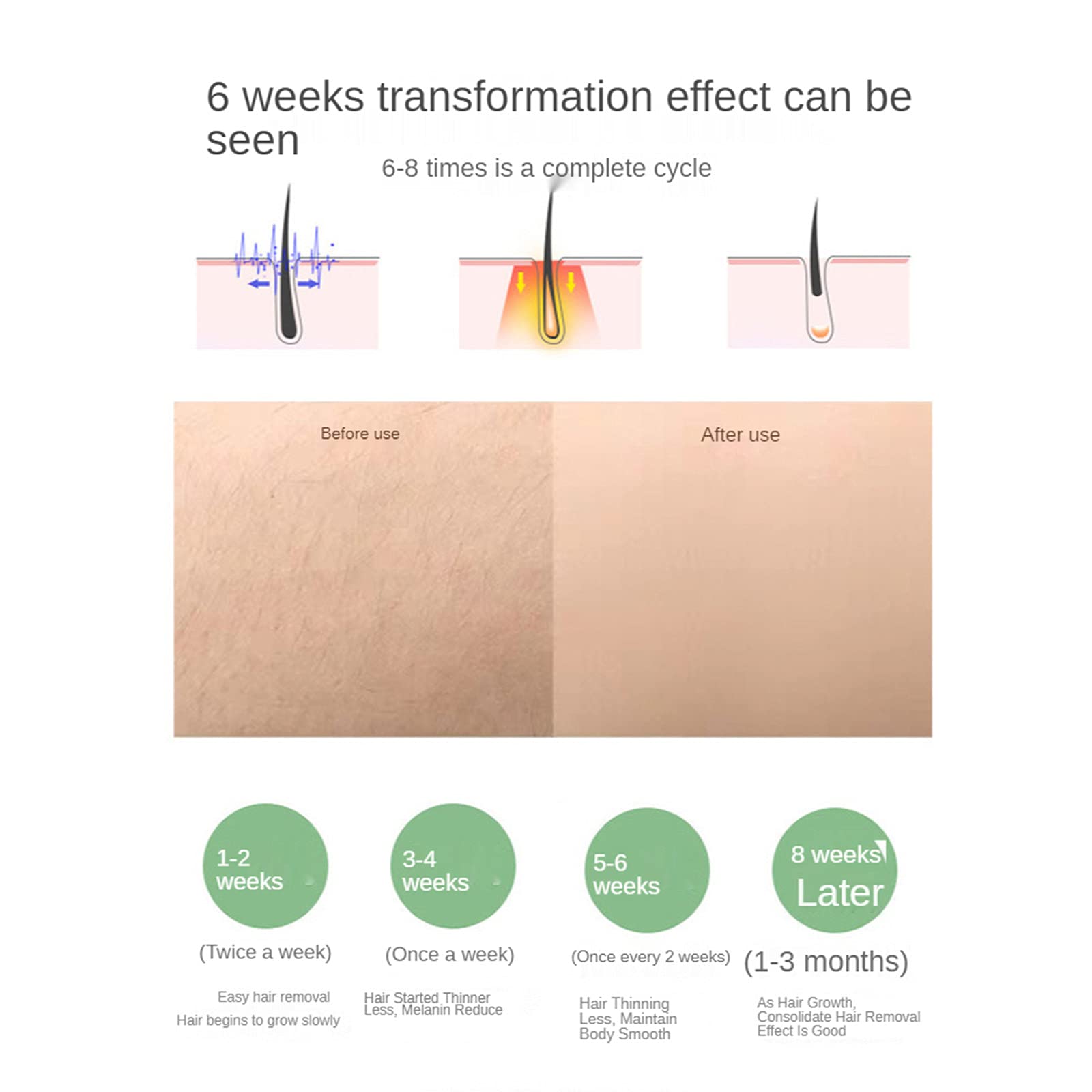 Professional IPL Hair Removal Device with Ice Cooling Technology - 999,999 Flashes Permanent Hair Removal System for Women & Men - Painless At-Home Hair Removal for Face, Body, Bikini Area - Perfect for Smooth Skin Before Beach Vacation or Special Occasions