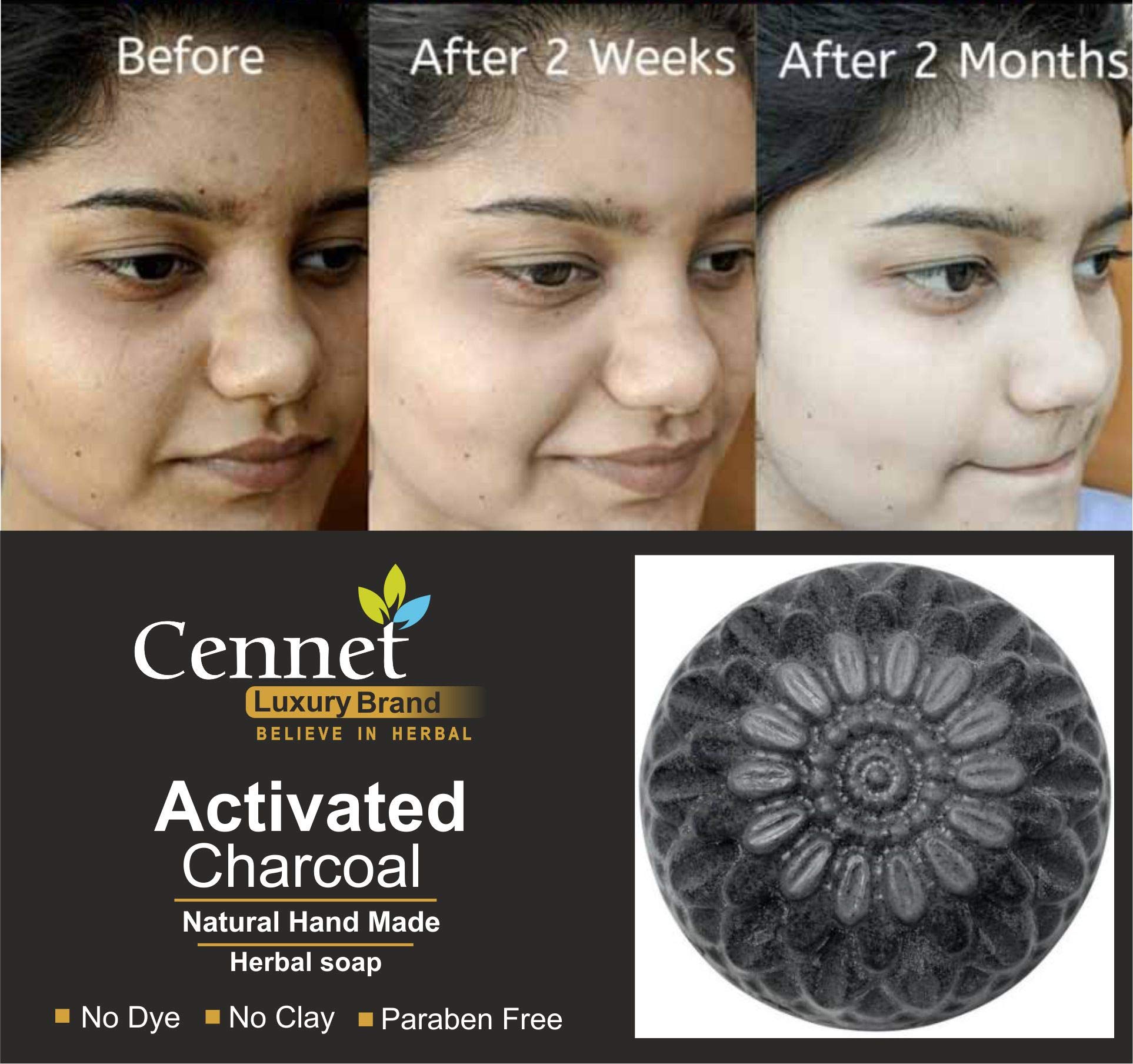 Organic Charcoal Soap for Women – Natural Skin Whitening, Detox Face & Body Cleanser for Acne, Blackheads, Anti-Wrinkle & Pimple Care | Chemical-Free, Handmade Beauty Soap | 100g | Perfect for Daily Skincare & Deep Cleansing Routine