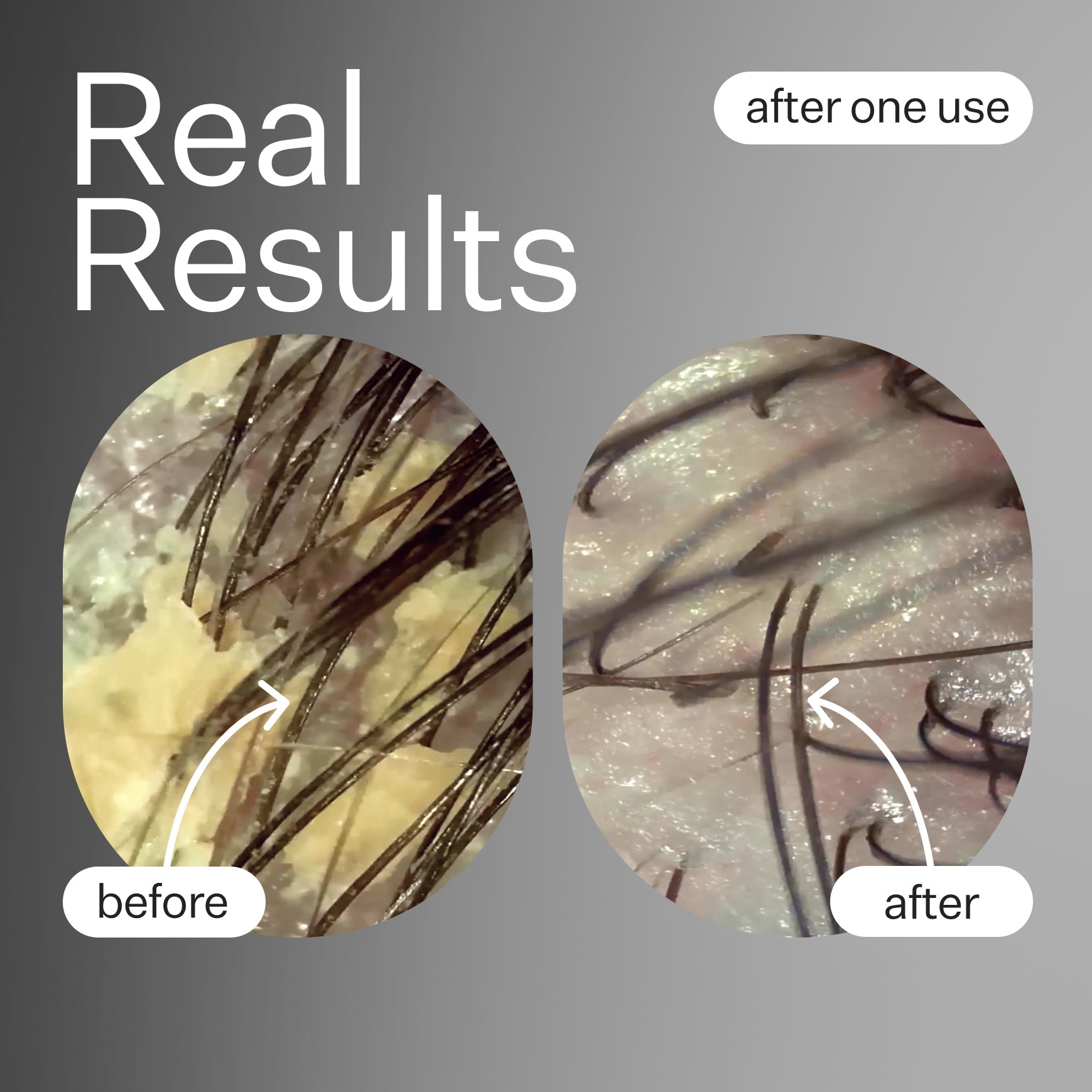 Scalp Renew Hair Growth Serum - Natural Scalp Treatment for Thicker, Healthier Hair - Perfect for Men & Women with Thinning Hair or Hair Loss - Use Daily for Best Results