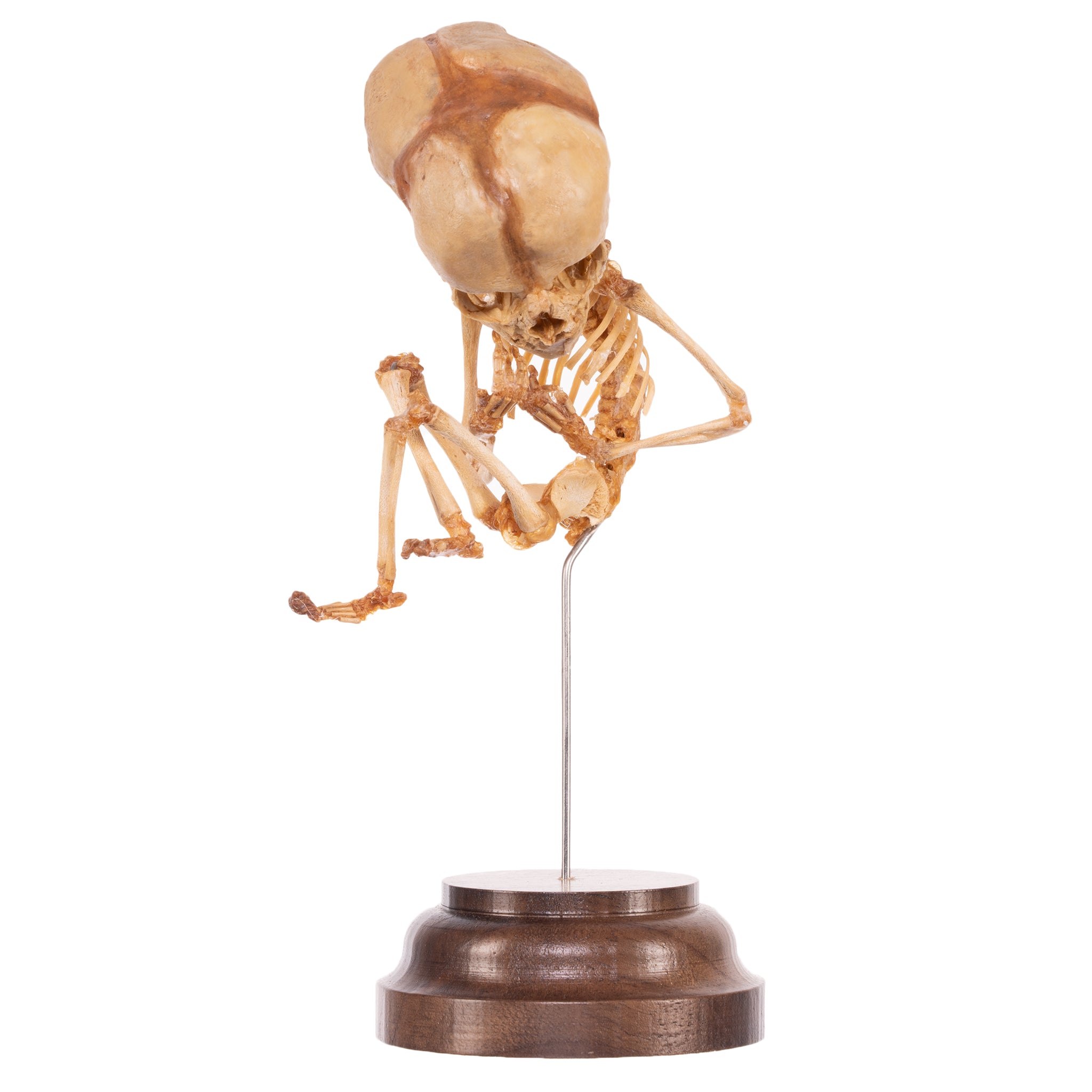 Authentic Human Fetal Skeleton Specimen on Display Stand - Ideal for Medical Education, Anatomy Studies & Research Laboratories