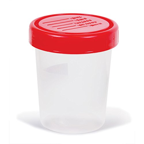 120mL Non-Sterile Specimen Containers with Screw-On Lids - Ideal for Medical Labs, Urine Samples & Scientific Research Collection