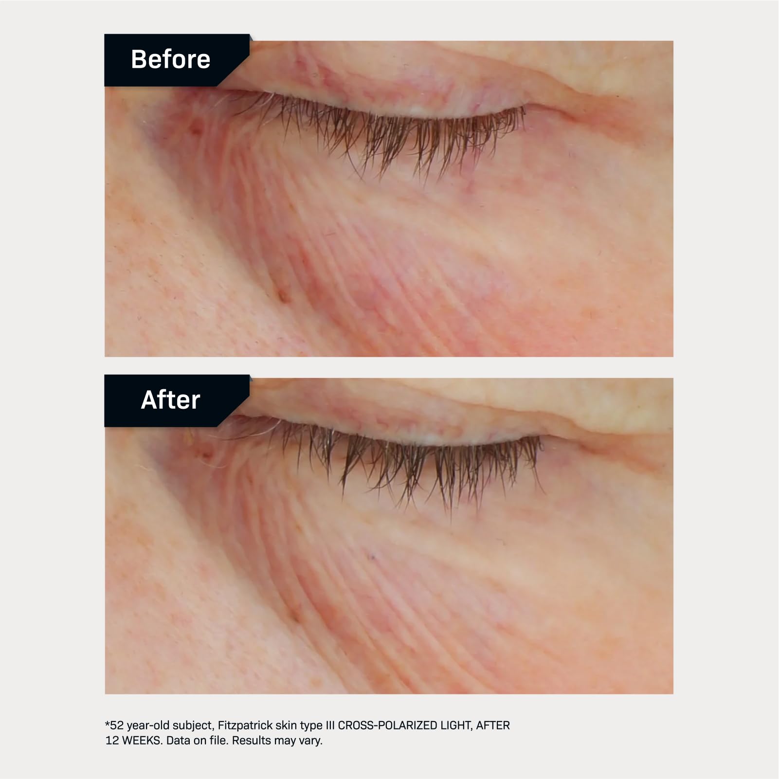 Revision Skincare C+ Brightening Eye Complex™ - Vitamin C & Antioxidant Eye Cream for Dark Circles & Puffiness | Brightens & Firms Under Eyes | Day & Night Use
