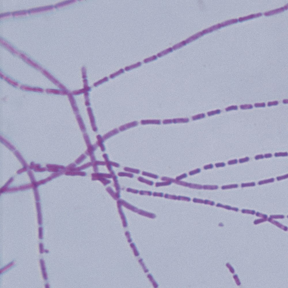 Bacterial Pathogens Microscope Slide Set - 12 Prepared Slides for Microbiology Study | Ideal for Lab Research, Medical Education & Science Classrooms