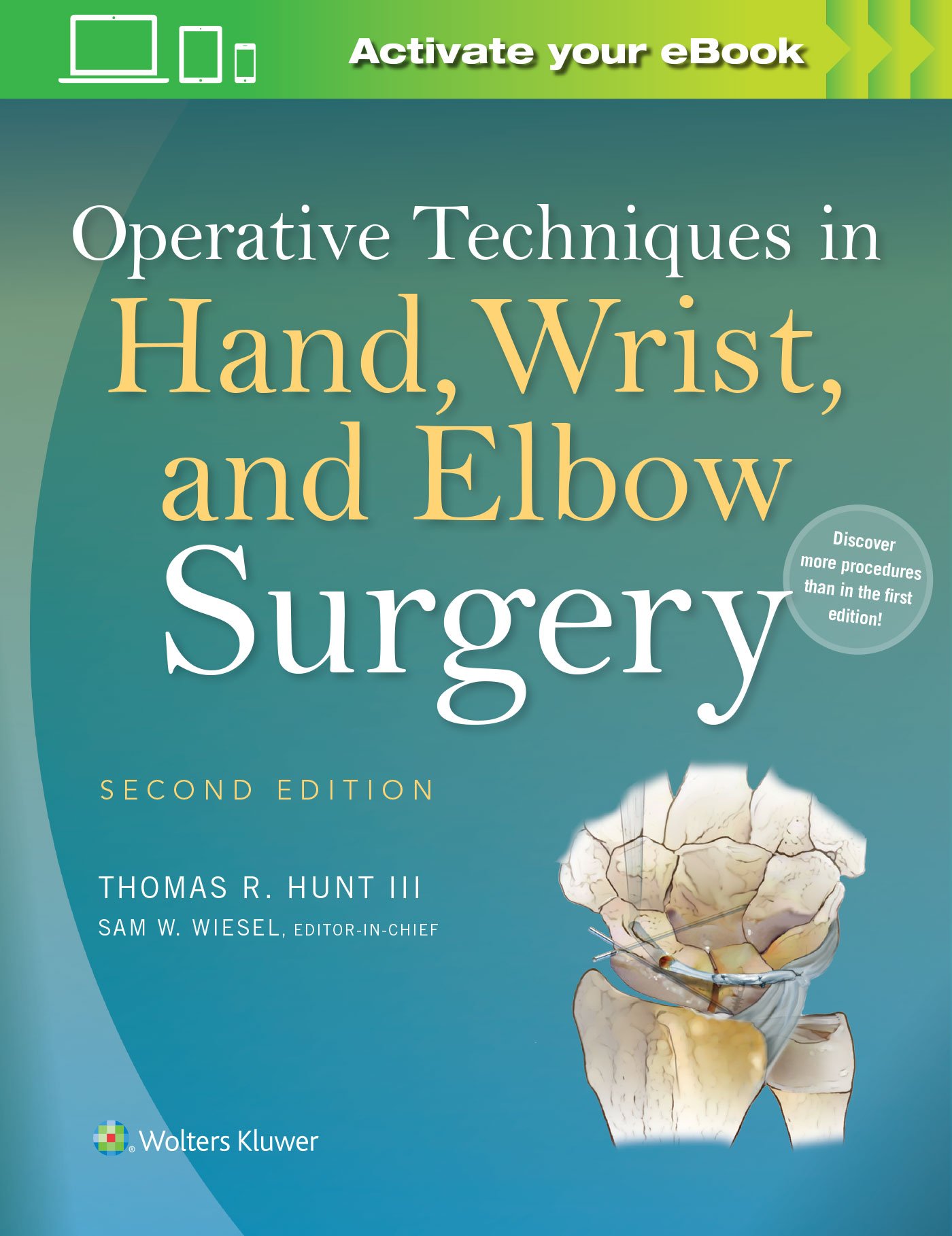 Operative Techniques in Hand, Wrist, and Elbow Surgery - Comprehensive Guide for Orthopedic Surgeons | Ideal for Medical Professionals & Surgical Training