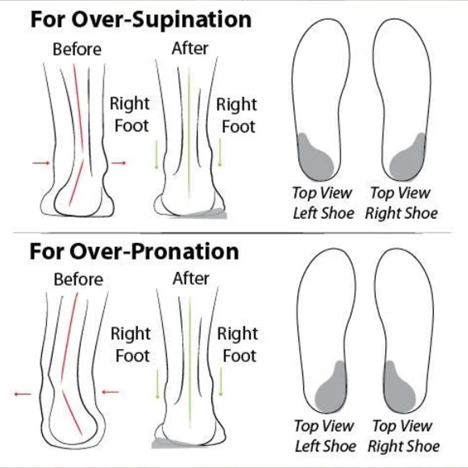 Women's Orthopedic Walking Shoes with Arch Support - Soft Sole Mesh Comfort Shoes for Women - Best for Plantar Fasciitis, Flat Feet & All-Day Comfort - Perfect for Work, Travel & Daily Walking
