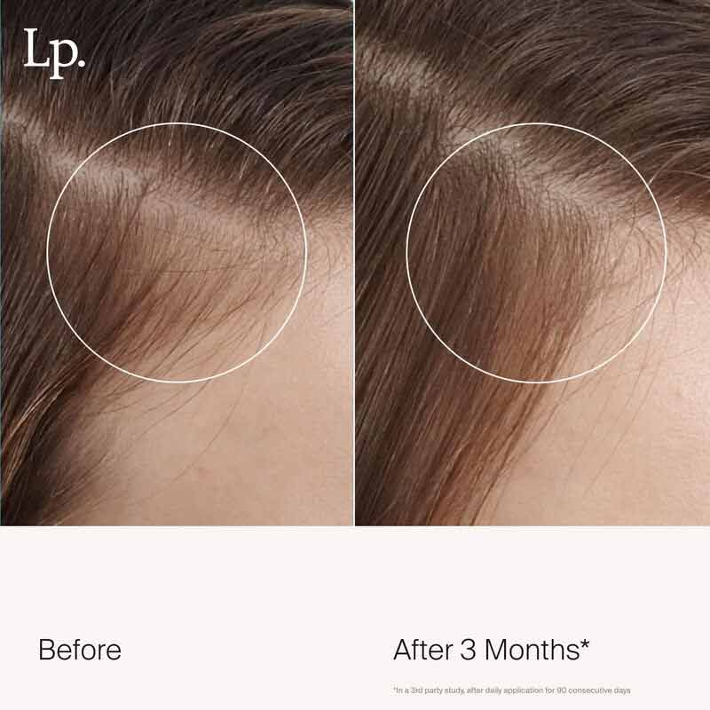Living Proof Scalp Care Revitalizing Treatment for Dry Itchy Scalp - Sulfate Free Hair Growth Serum with Biotin & Caffeine - Perfect for Thinning Hair & Scalp Health - Use for Daily Scalp Massage & Hair Regrowth