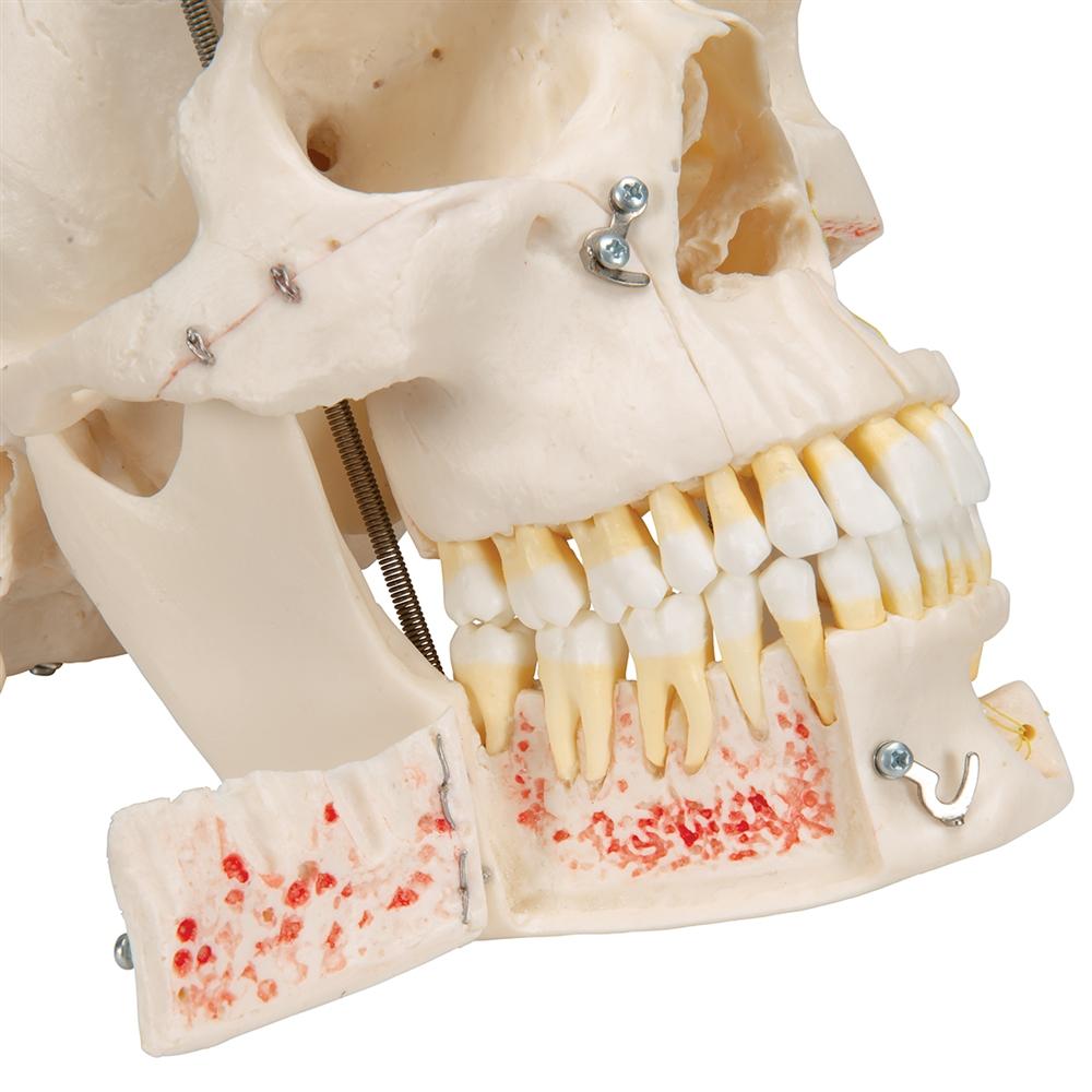 Premium 10-Part Dental Skull Model for Human Anatomy Demonstration - Ideal for Dental Students, Professionals & Medical Education