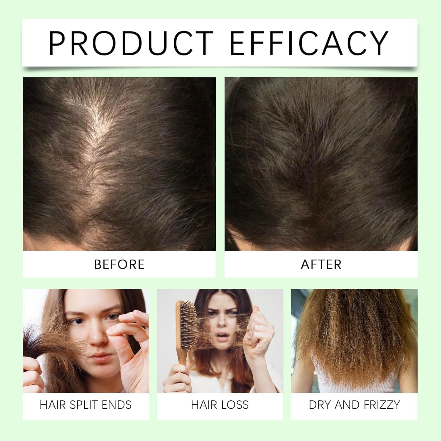 Batana Oil Shampoo for Hair Loss - 300ml Natural Hair Growth Shampoo with Batana Oil (2 Pack) - Strengthens & Nourishes Hair for Men & Women - Perfect for Thinning Hair & Scalp Care