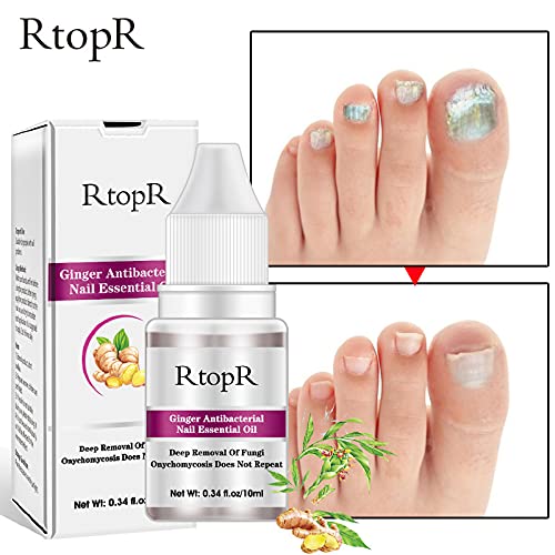 RtopR Nail Repair Liquid - Antifungal Treatment for Onychomycosis, Moisturizing Nail Care Essence with Ginger Extract - Perfect for Damaged, Brittle Nails & Fungal Infections at Home or Salon Use