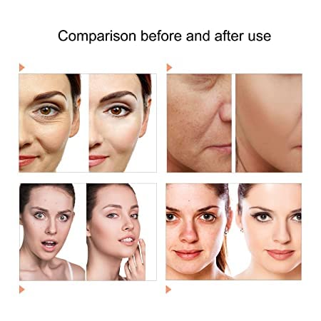 Kostech 7-Color LED Face Mask for Skin Rejuvenation - PDT Photon Therapy Light for Face & Body, Touch Screen Control - Anti-Aging, Whitening & Acne Treatment | Home Spa & Professional Beauty Equipment