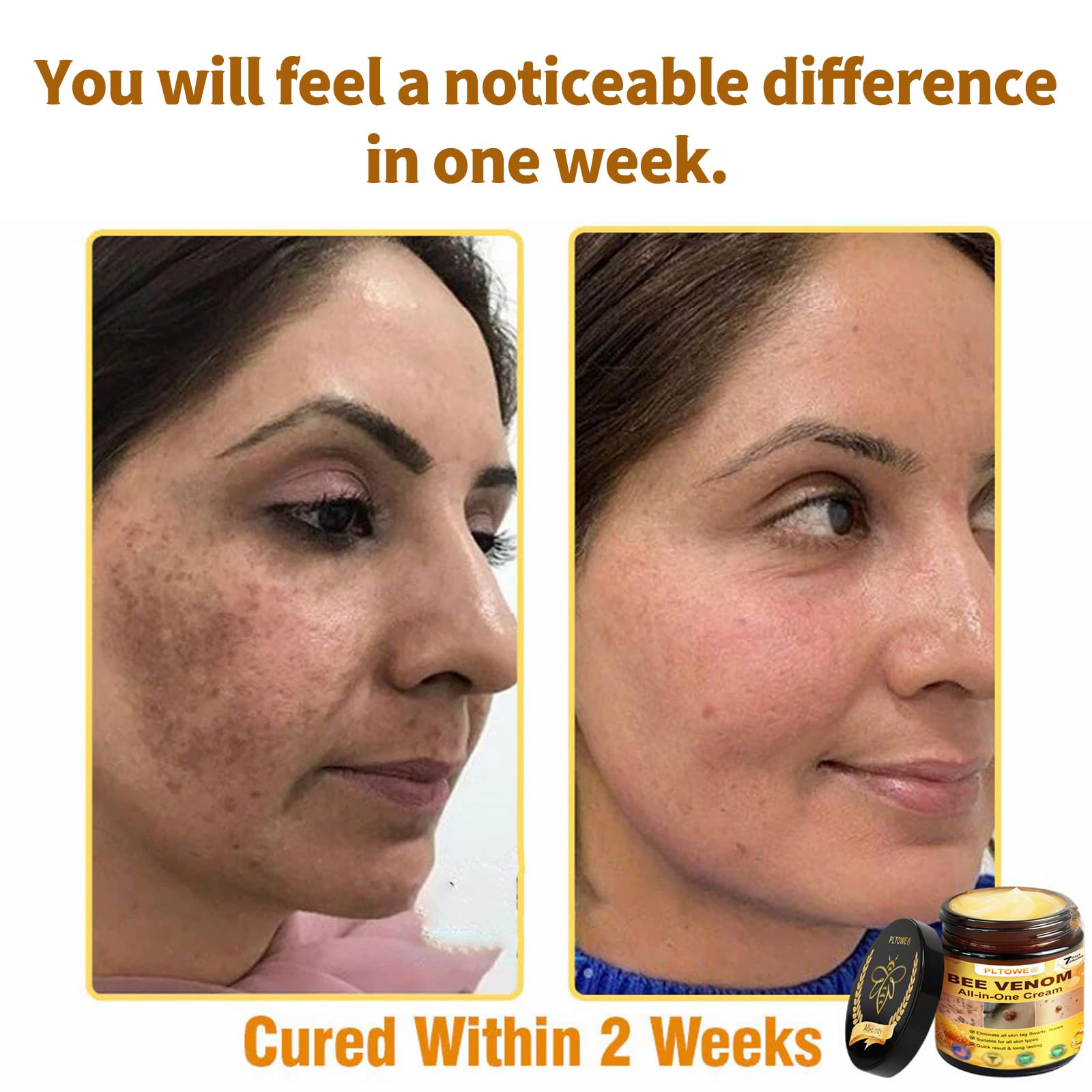 PLTOWE Bee Venom All-in-One Face Cream - Anti-Aging & Skin Repair Treatment for Wrinkles, Dark Spots & Acne | Natural Bee Venom Skincare for Glowing Complexion | Day & Night Moisturizer for Women & Men