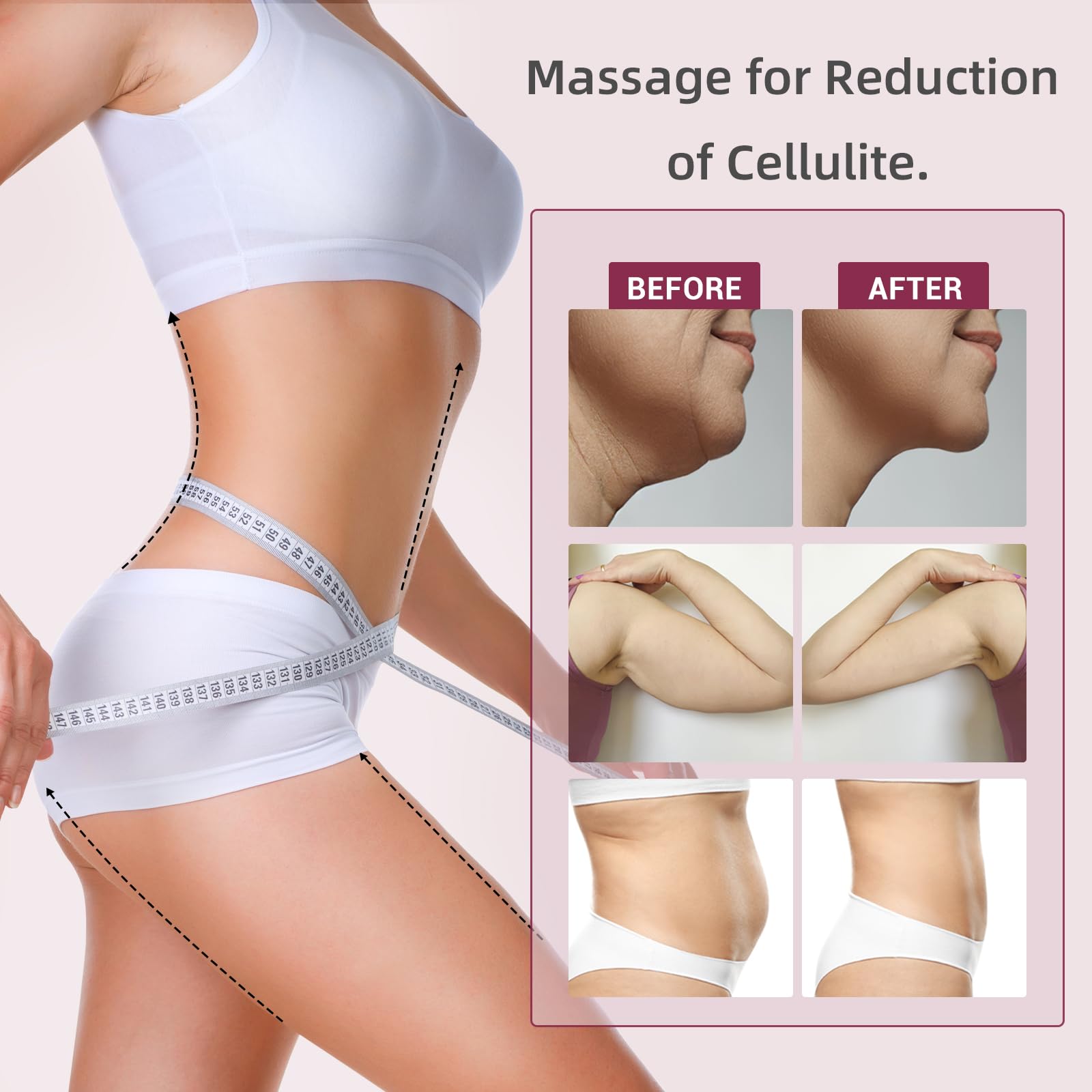 Palm NRG Radio Frequency Cellulite Massager - Temporary Cellulite Reduction Device for Body Contouring | At-Home Spa Treatment & Post-Workout Recovery
