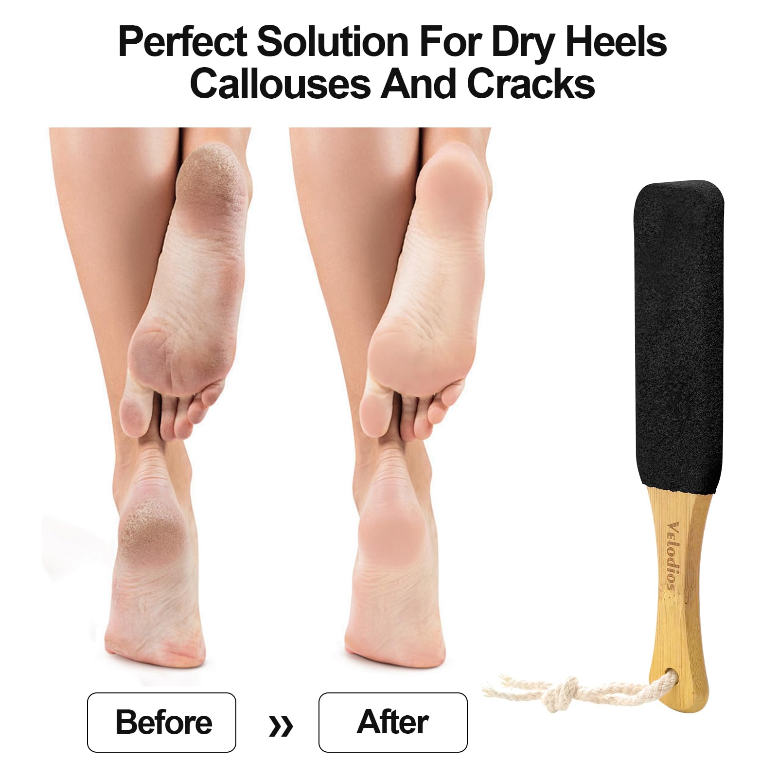 Professional Pedicure Tools Kit - 2 Pack Foot Scrubber with Handle for Cracked Heels, Dead Skin & Corn Removal - Foot File, Massage Brush & Scraper for Men & Women (Black) - Perfect for Home Spa & Foot Care Routine