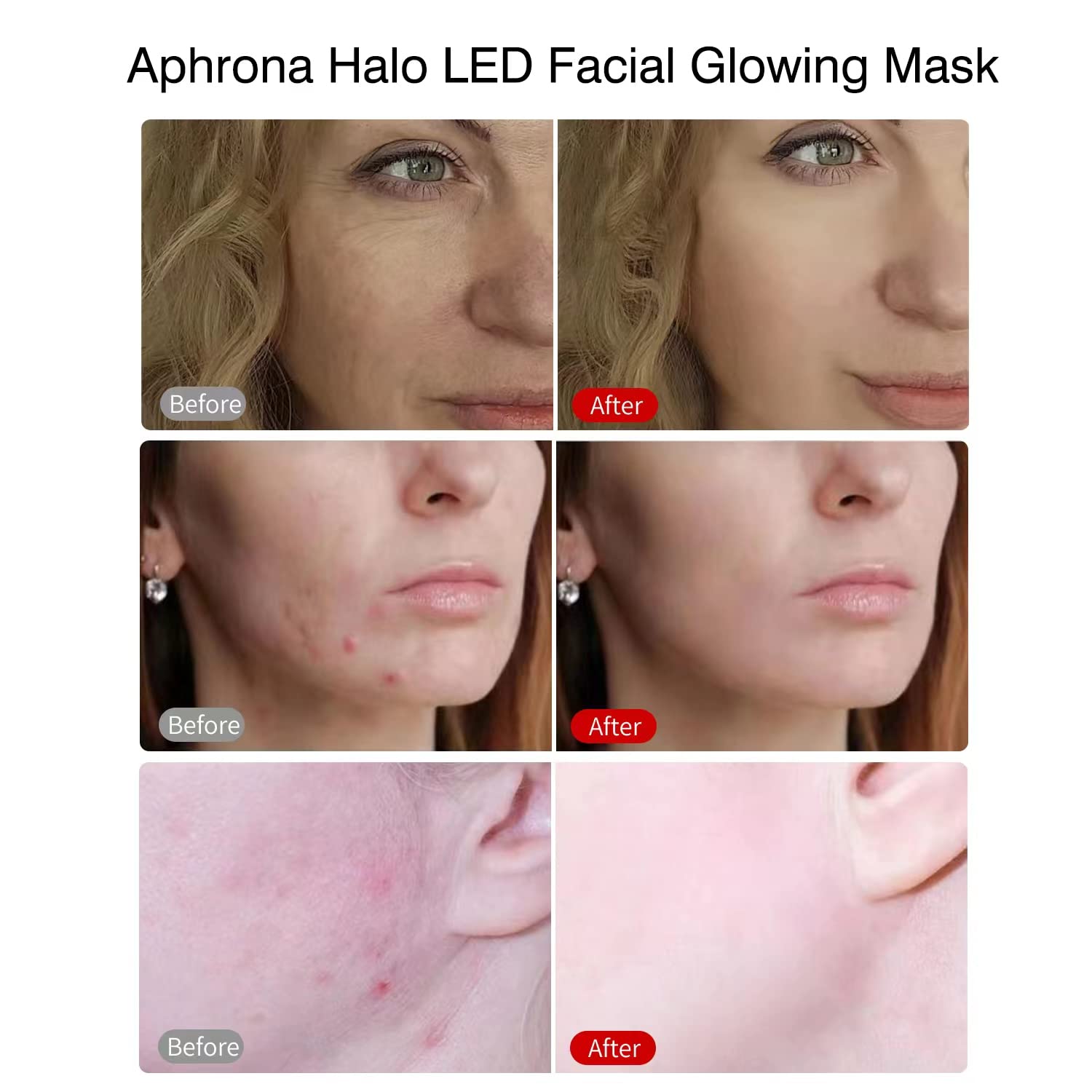 Aphrona® Halo LED Light Therapy Face Mask - Blue & Red Light Photon Therapy for Acne Treatment, Wrinkle Reduction & Skin Rejuvenation | At-Home Skincare Device for Anti-Aging & Clear Complexion (White) | Perfect for Daily Skincare Routine & Spa Treatments