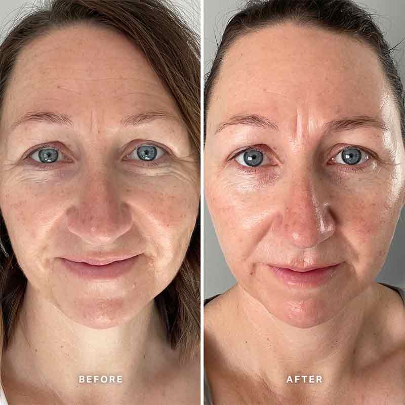 Alpha H Vitamin E Serum with 1% Ceramide Complex - Anti-Aging Face Serum for Hydration & Skin Repair - Perfect for Dry, Sensitive Skin & Nighttime Skincare Routine